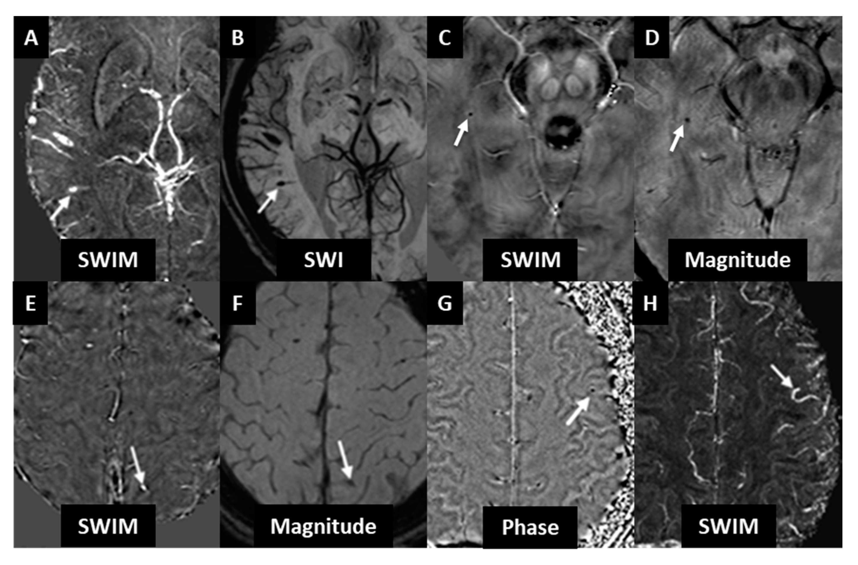 Diagnostics 10 00942 g001