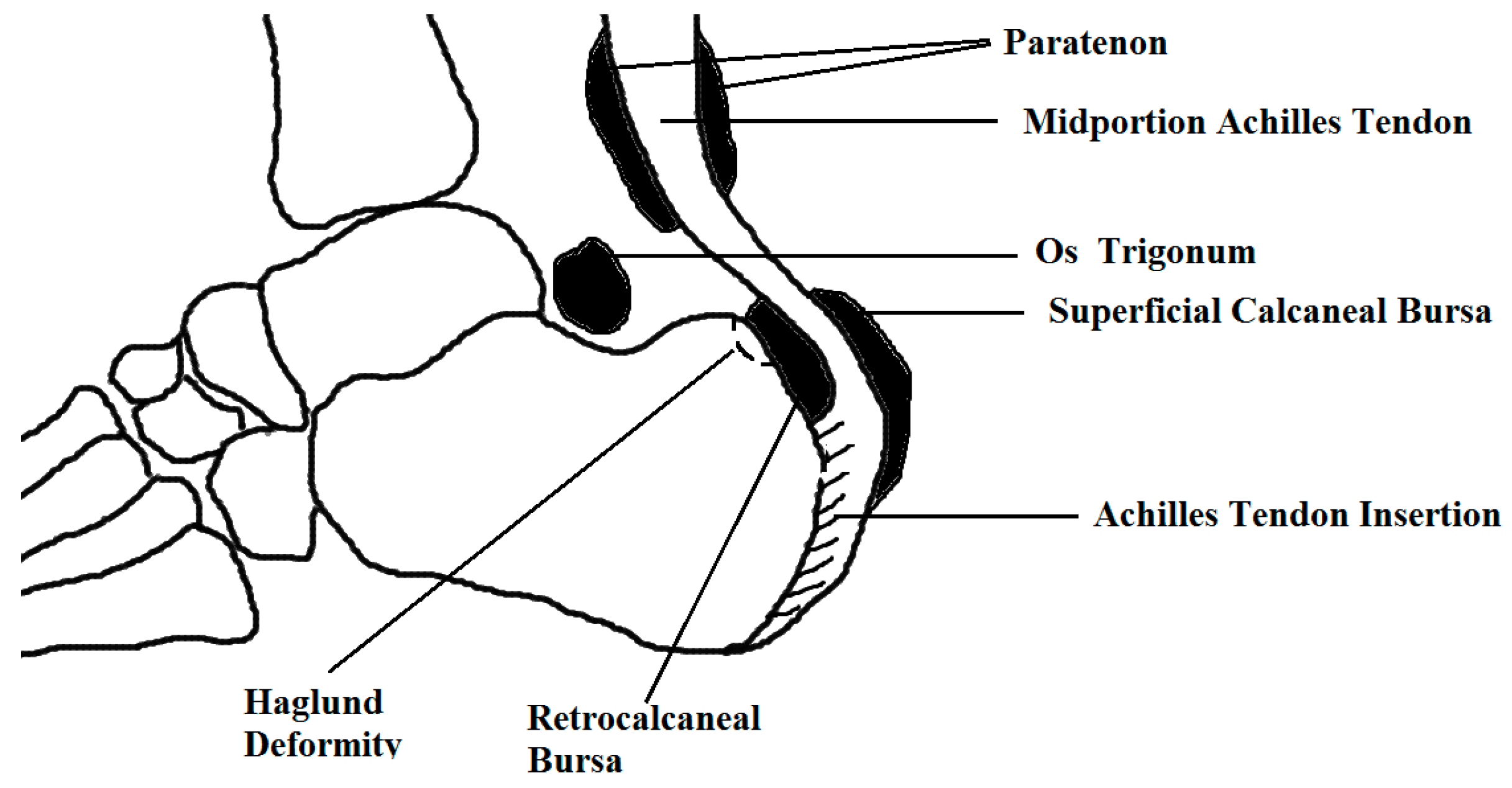 area code of va achilles