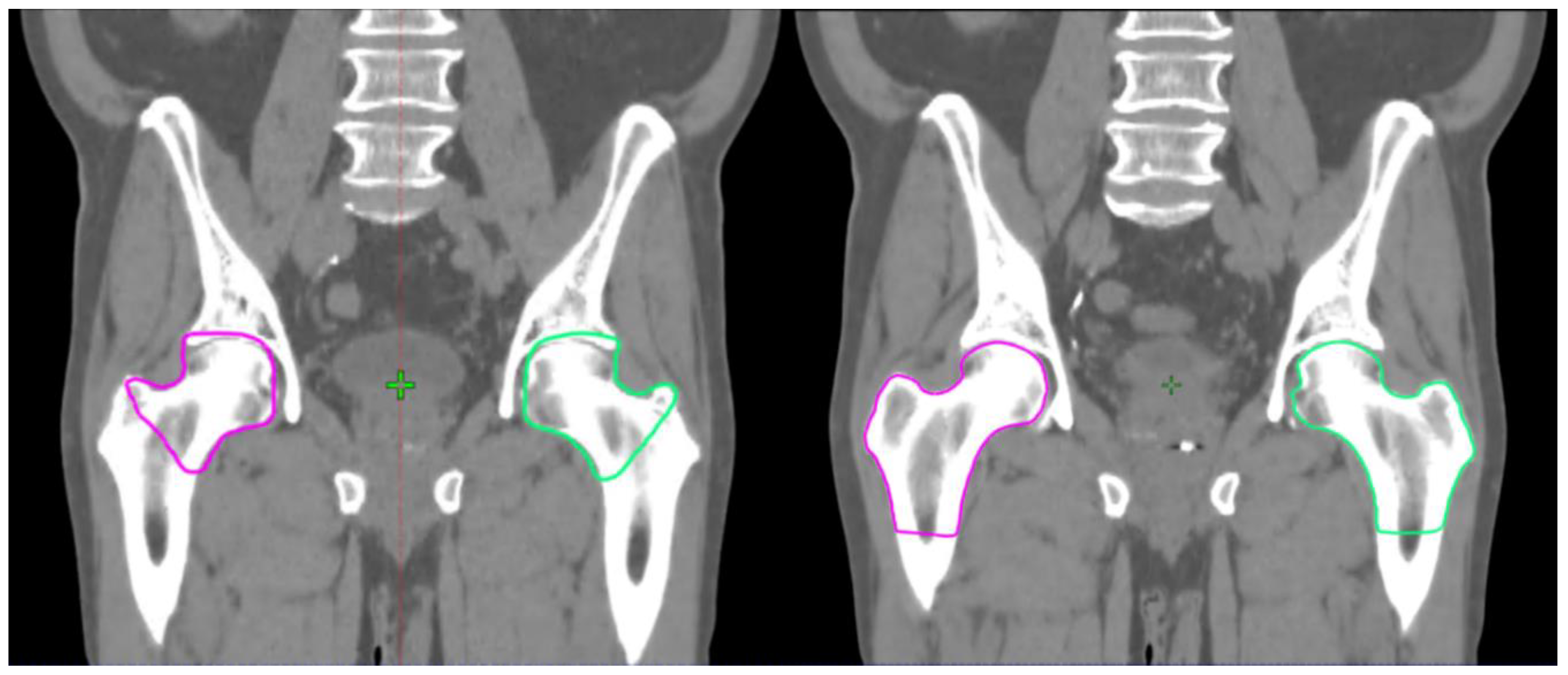 how to read mri images with dcss how to read mri images with dcss