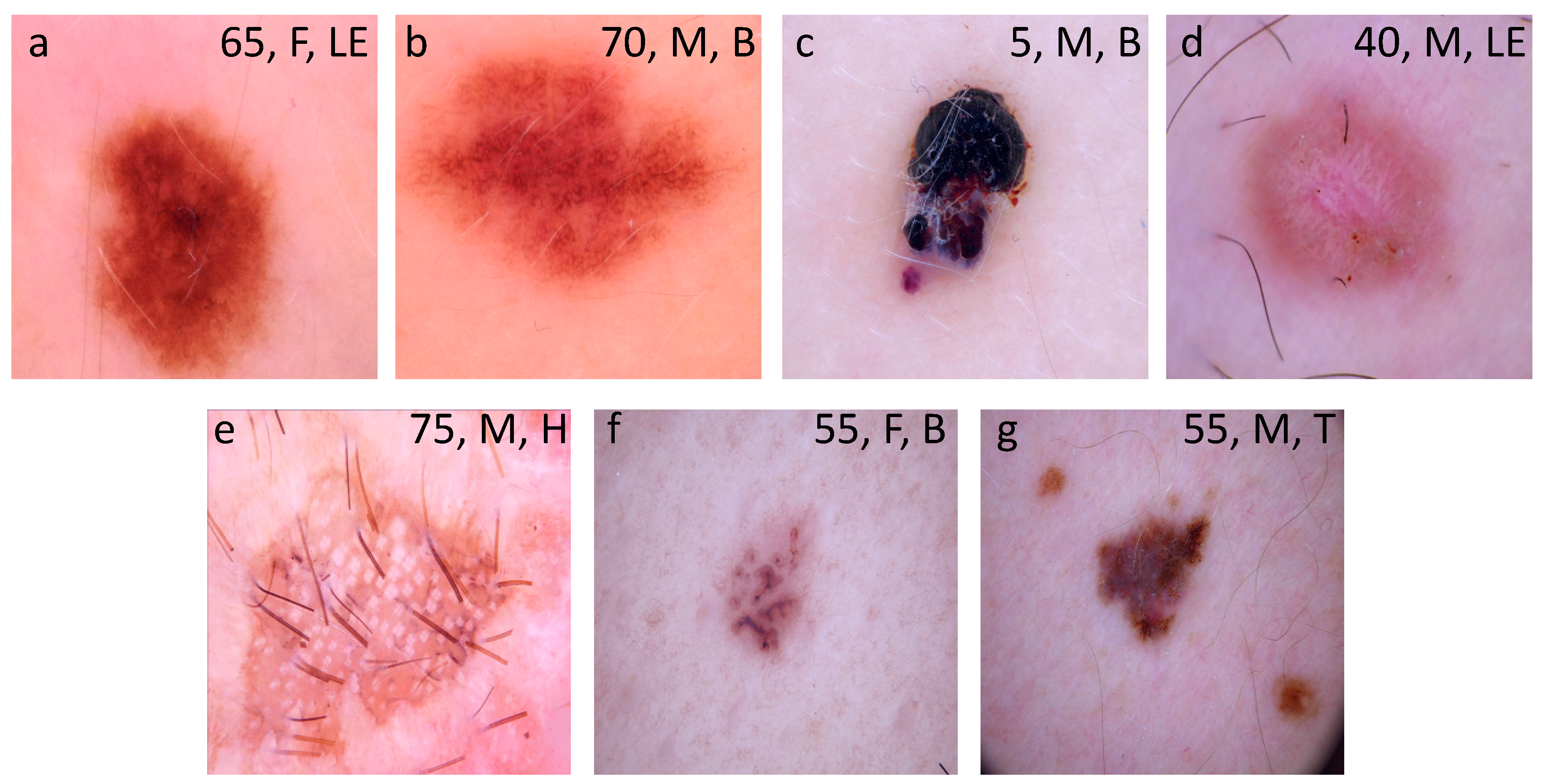 Diagnostics 10 00969 g001