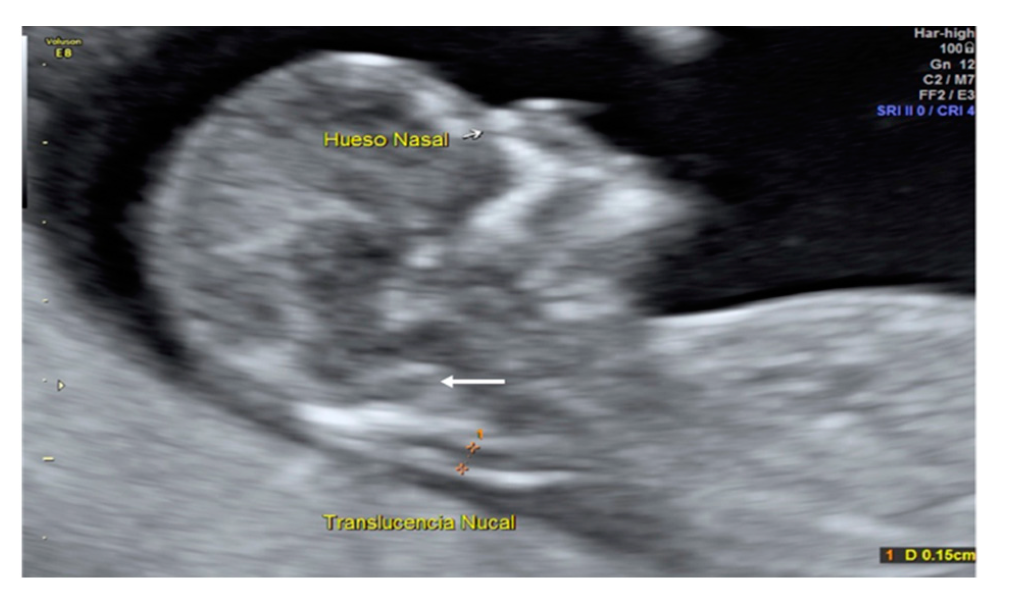 Diagnostics 10 00986 g002