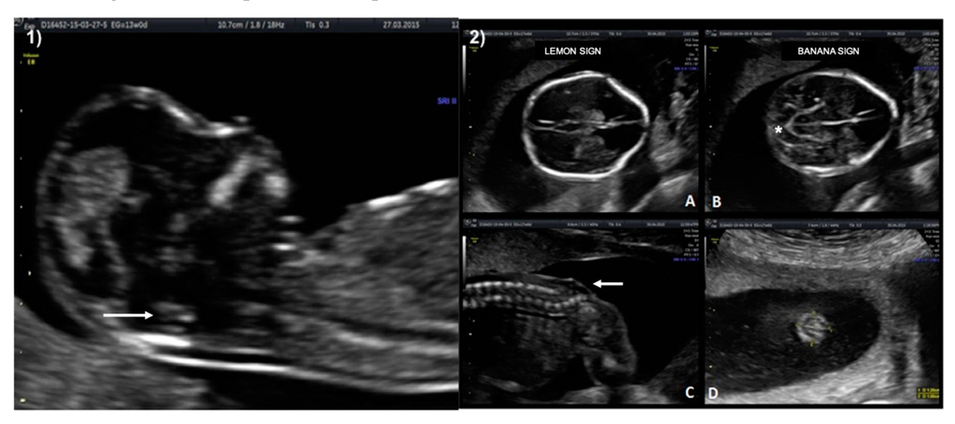 Diagnostics 10 00986 g003