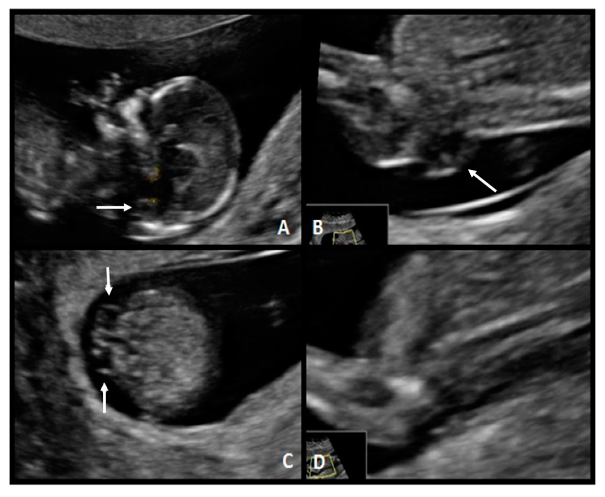 Diagnostics 10 00986 g004