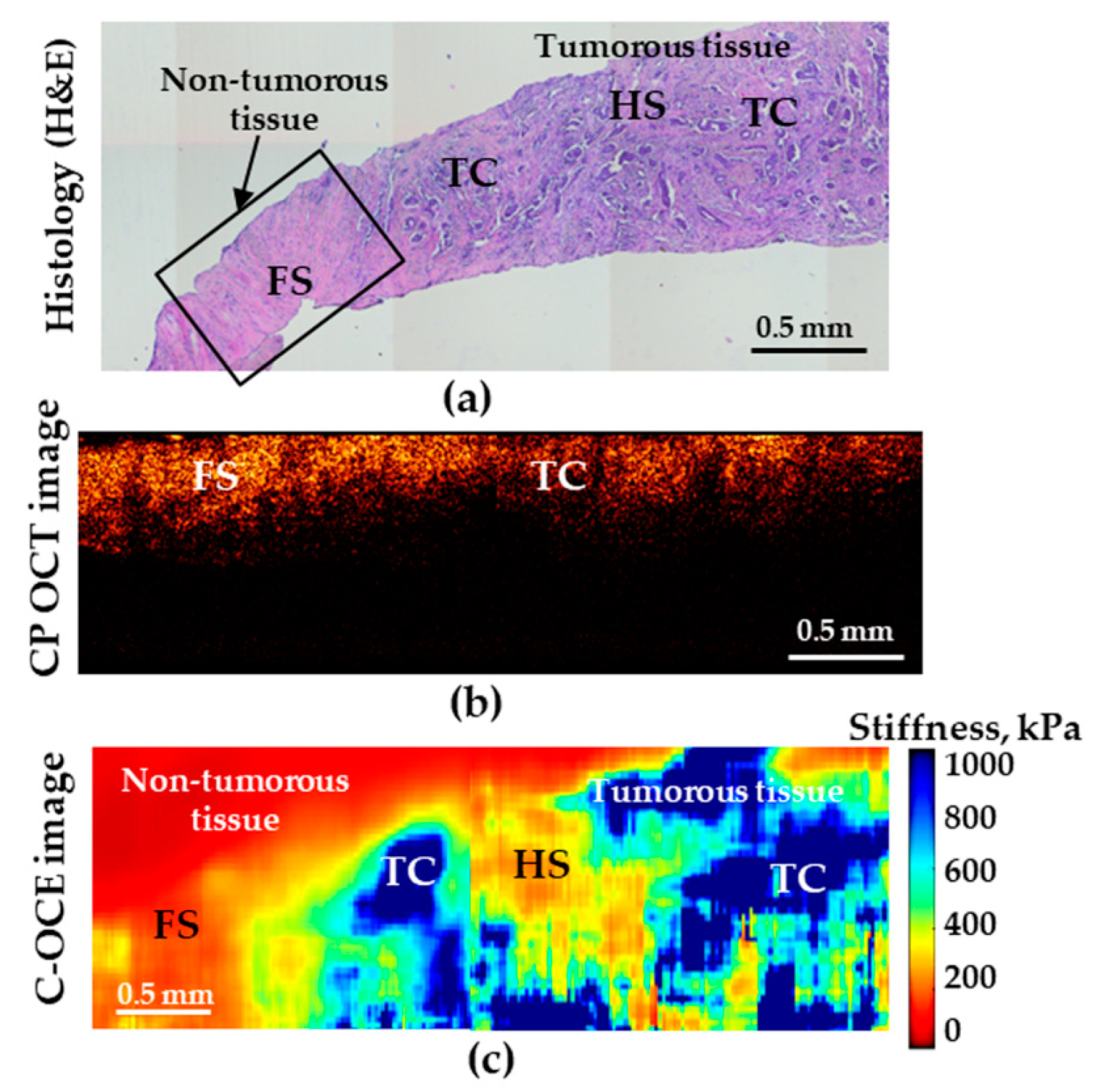 Diagnostics 10 00994 g005 Diagnostics 10 00994 g005