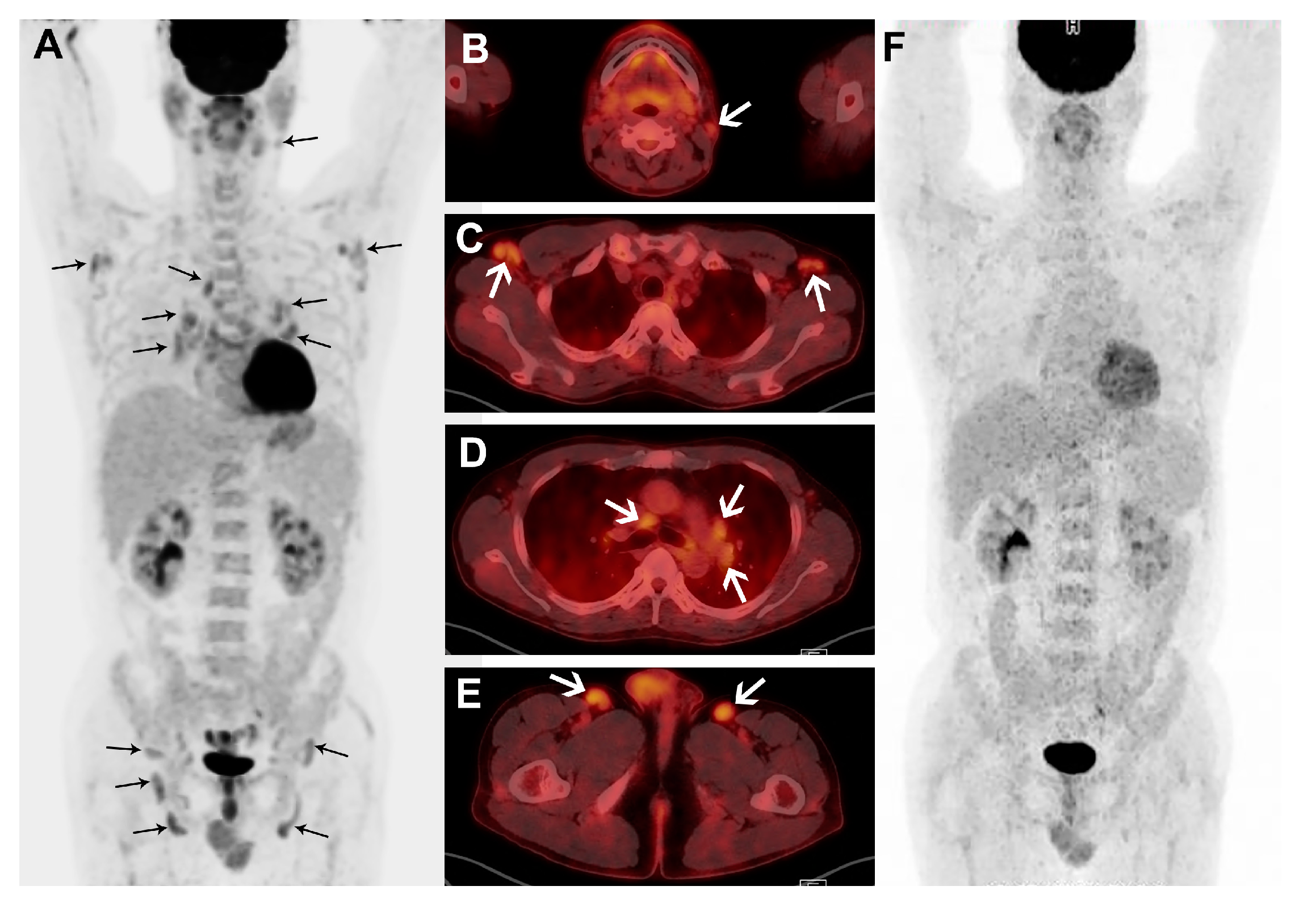 Diagnostics 10 00998 g003 Diagnostics 10 00998 g003