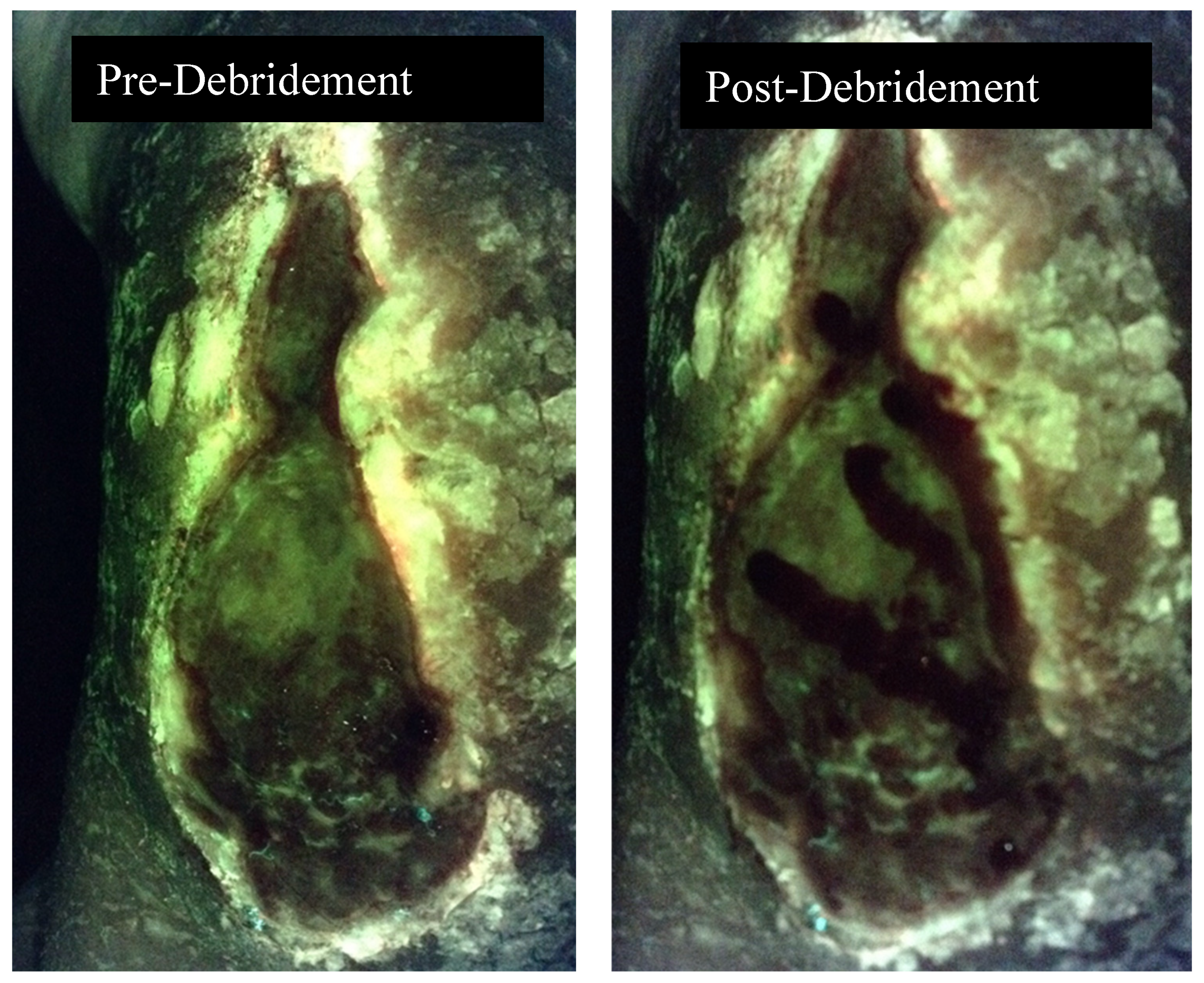 Diagnostics 10 01010 g002 Diagnostics 10 01010 g002