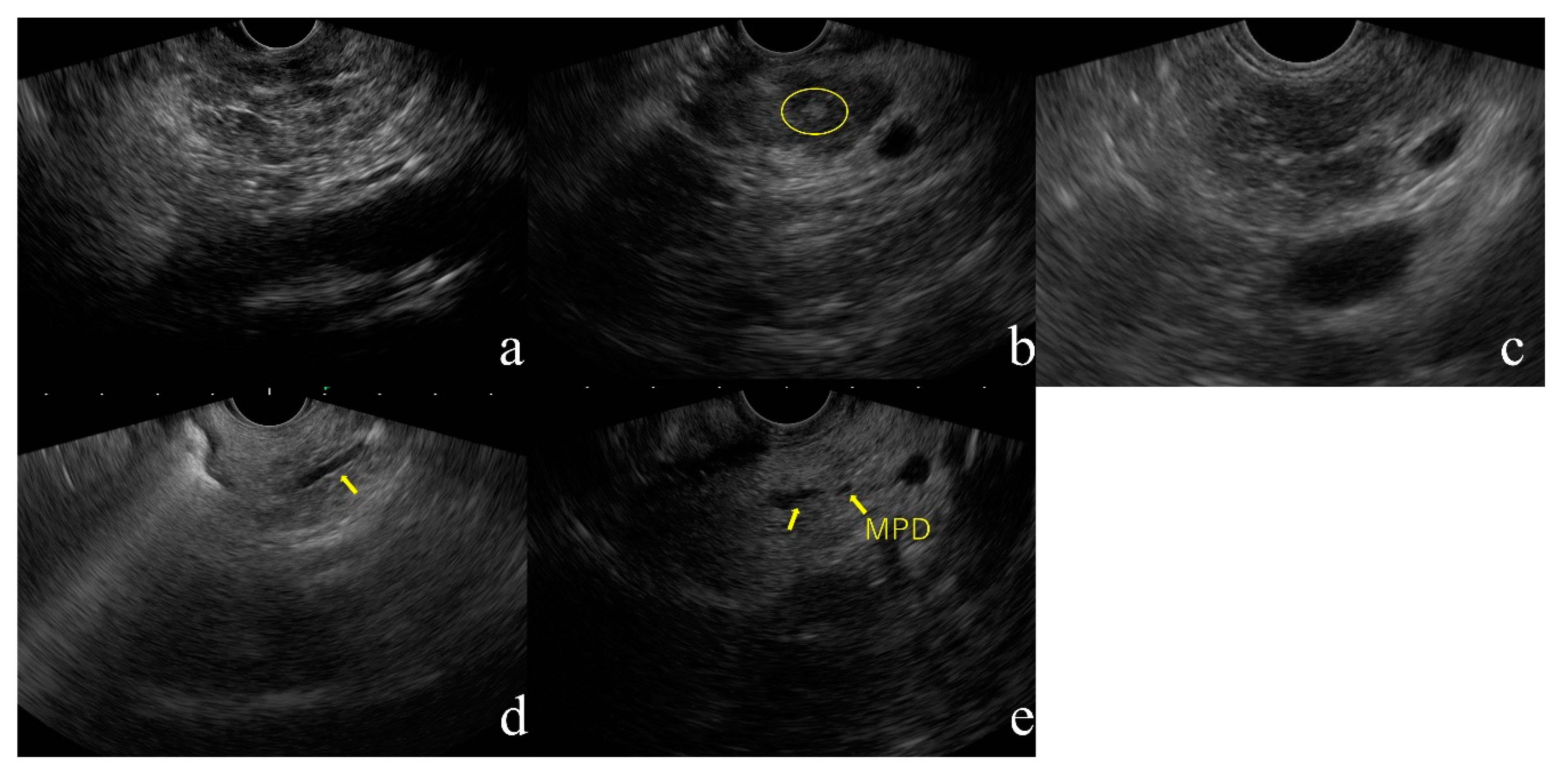 Diagnostics 10 01018 g001 Diagnostics 10 01018 g001