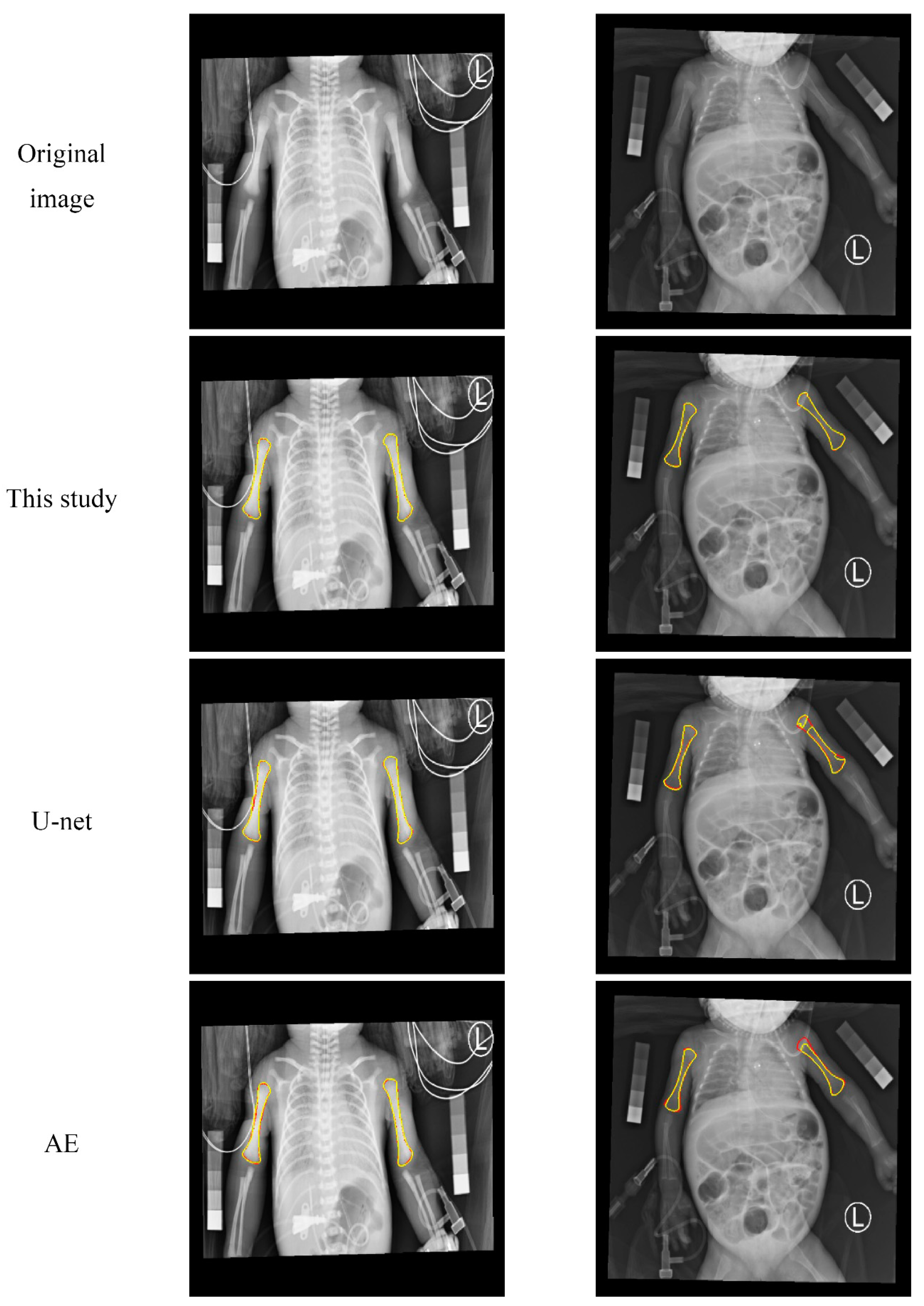 Diagnostics 10 01028 g008 Diagnostics 10 01028 g008