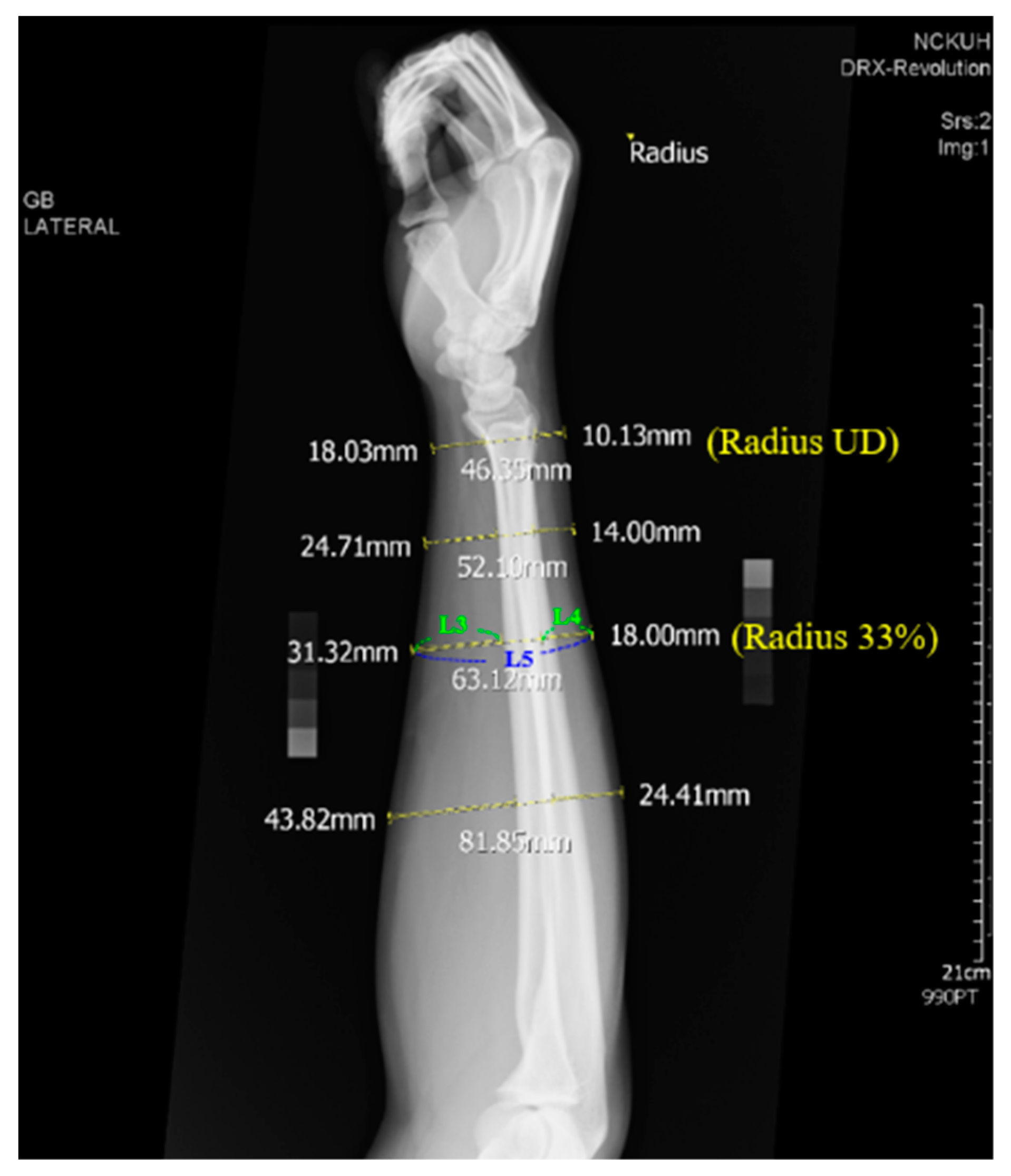 Diagnostics 10 01028 g010 Diagnostics 10 01028 g010