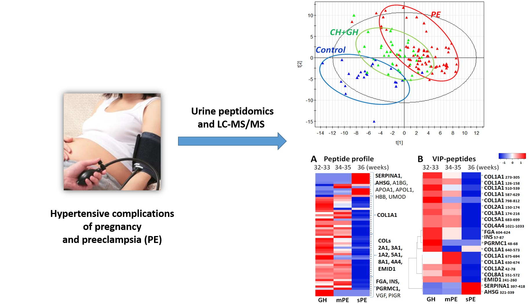 Diagnostics Free FullText Differential Diagnosis of Preeclampsia