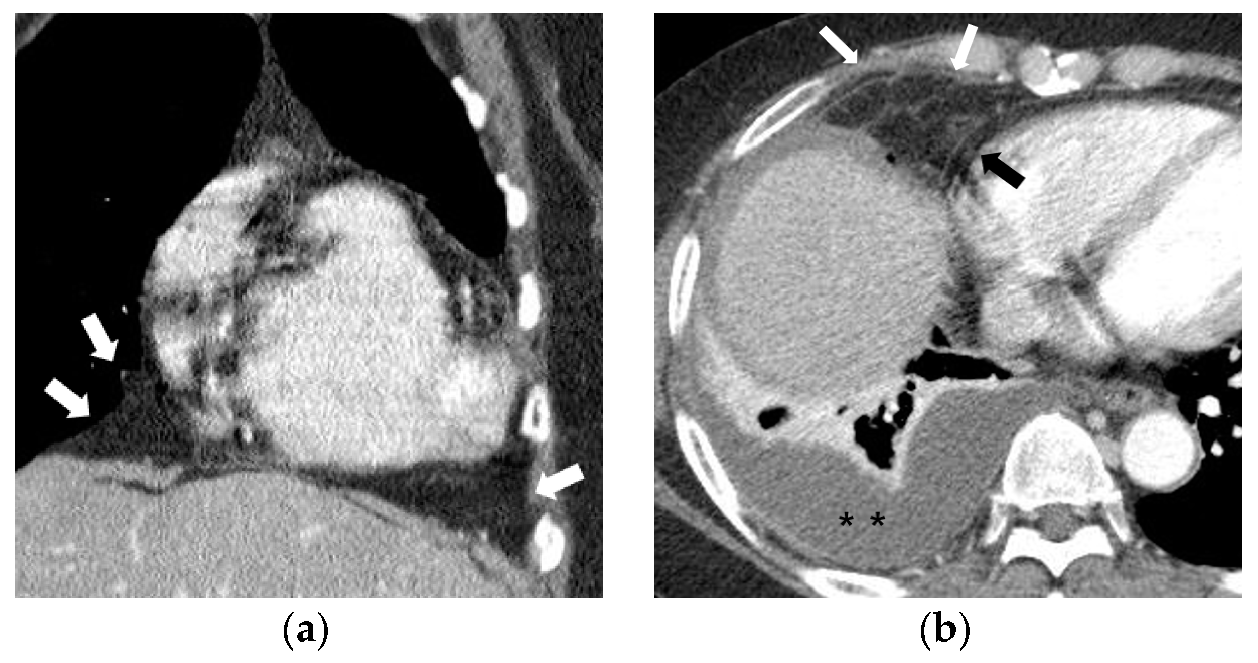 Diagnostics 10 01041 g002a