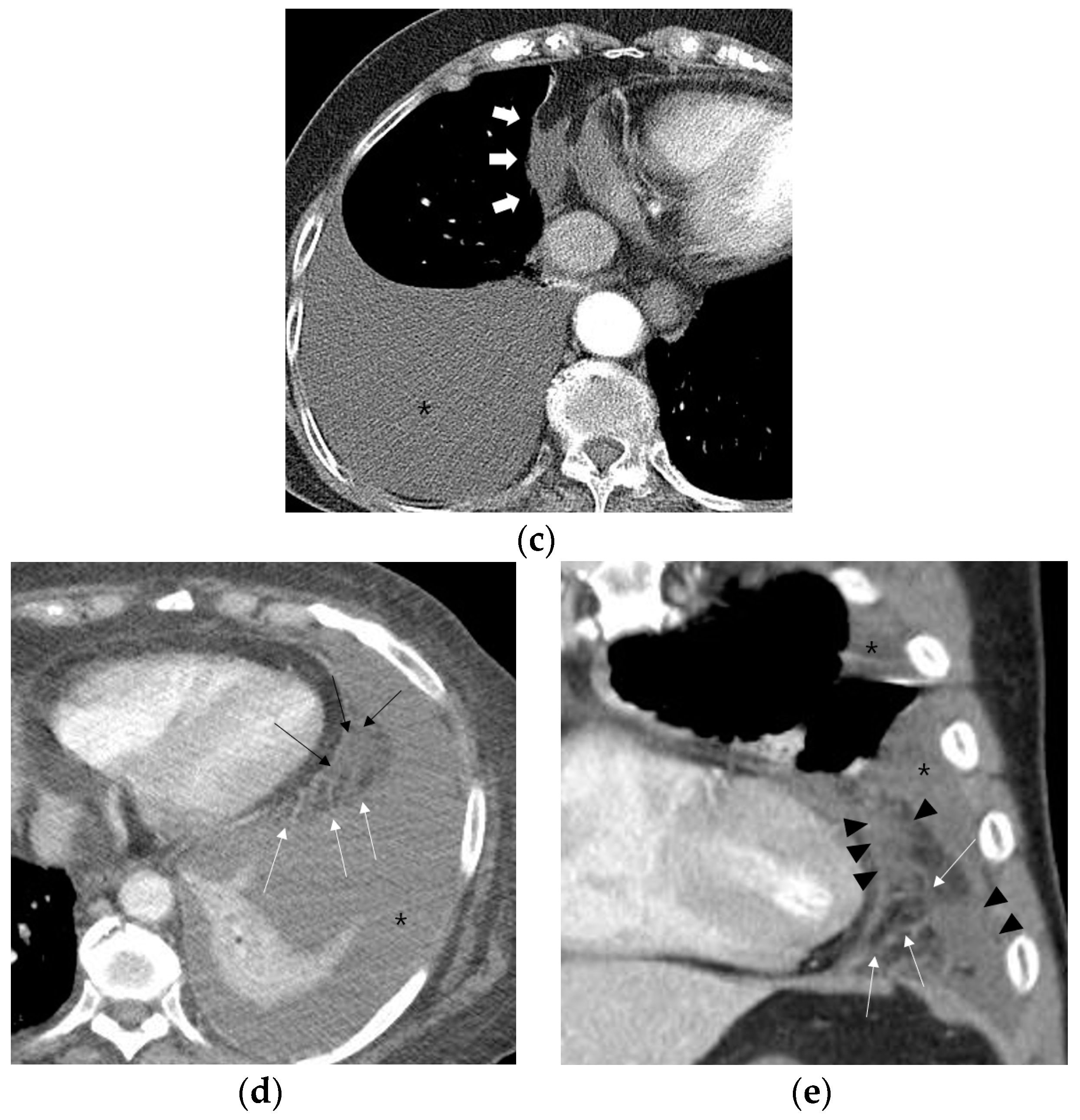 Diagnostics 10 01041 g002b