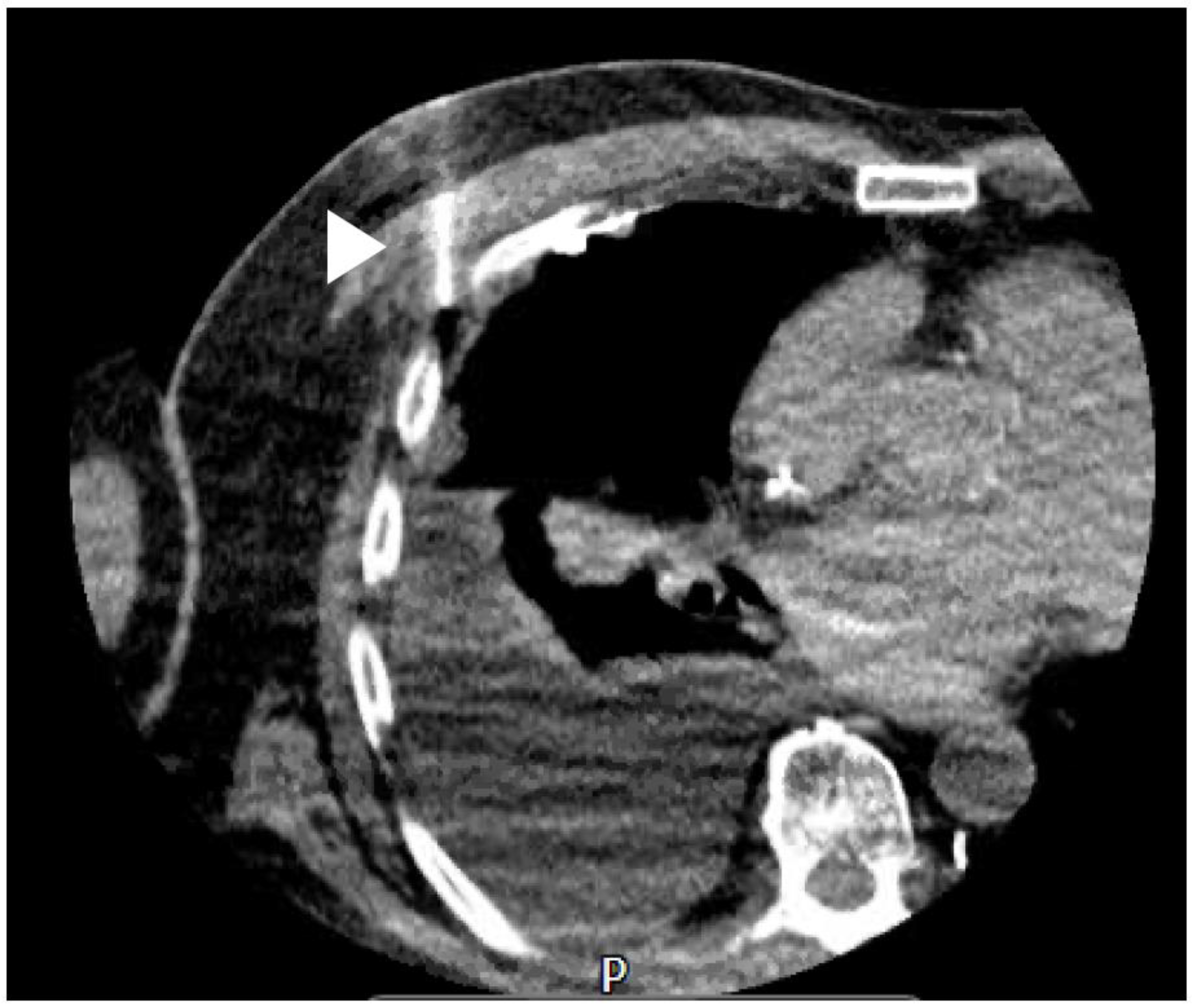 Diagnostics 10 01046 g004 Diagnostics 10 01046 g004