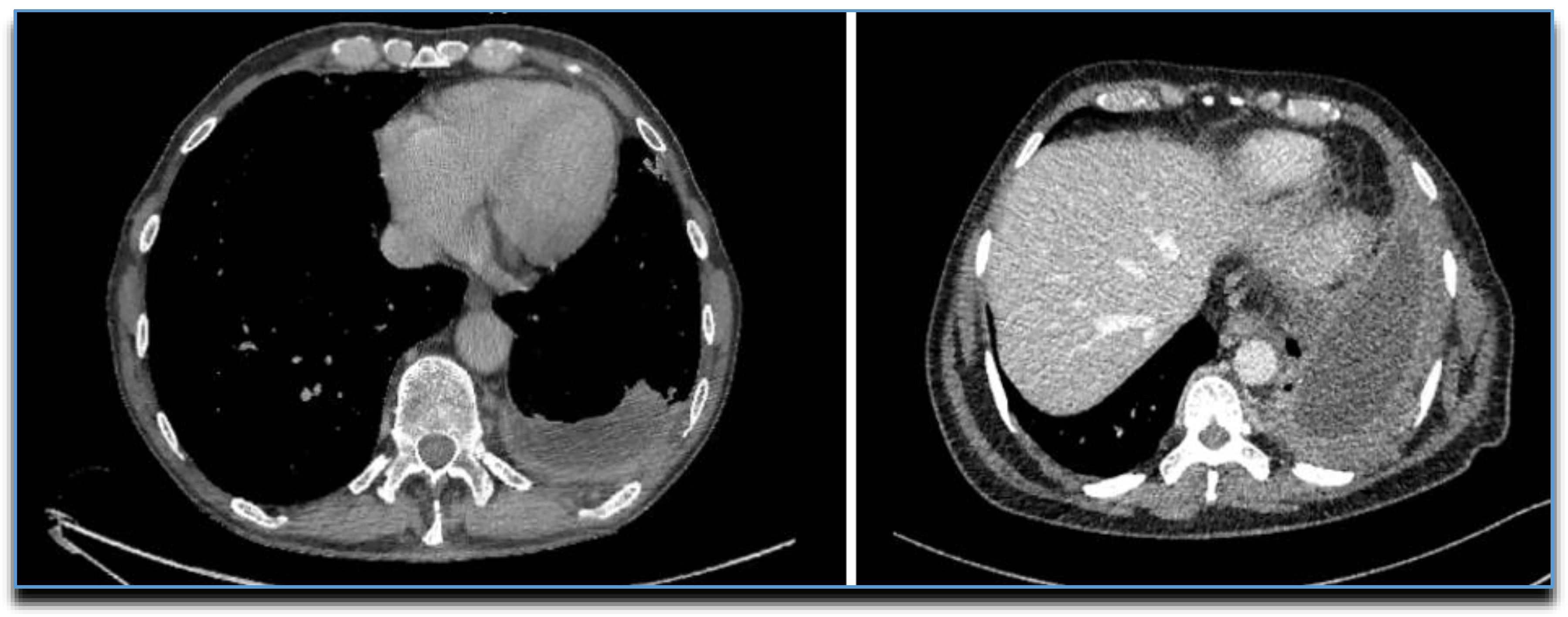 Diagnostics 10 01046 g008 Diagnostics 10 01046 g008