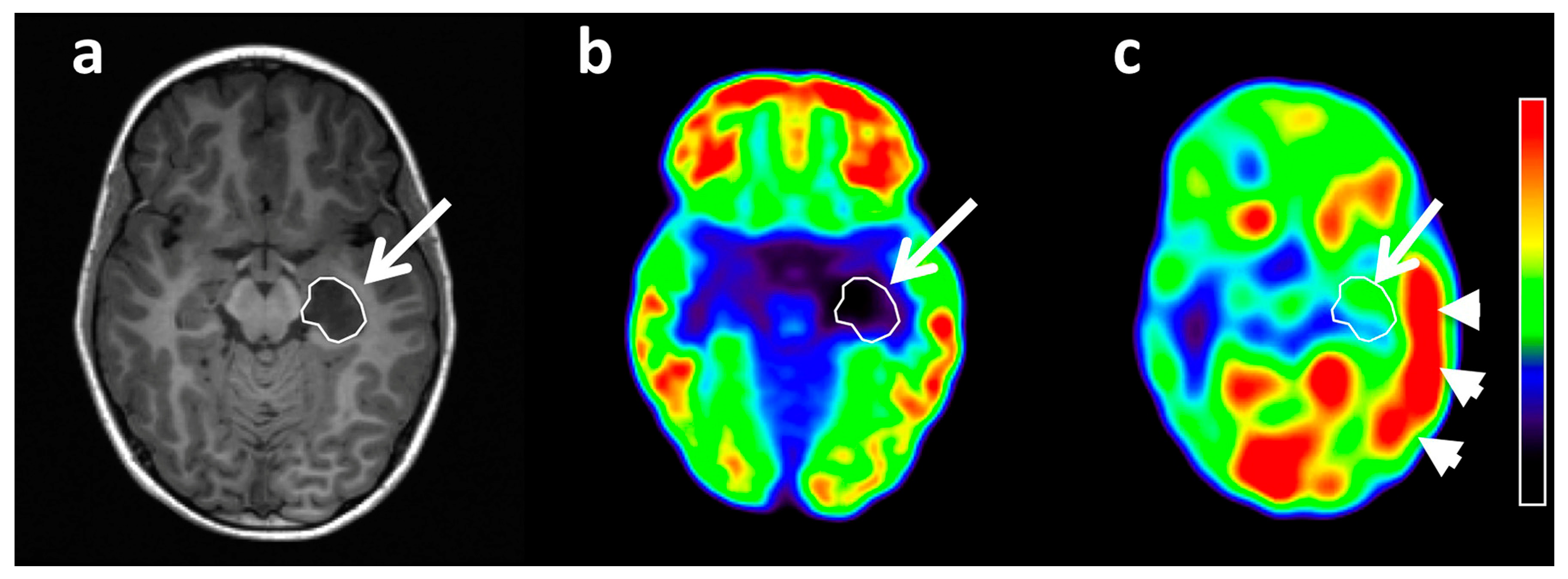Diagnostics 10 01049 g002 Diagnostics 10 01049 g002