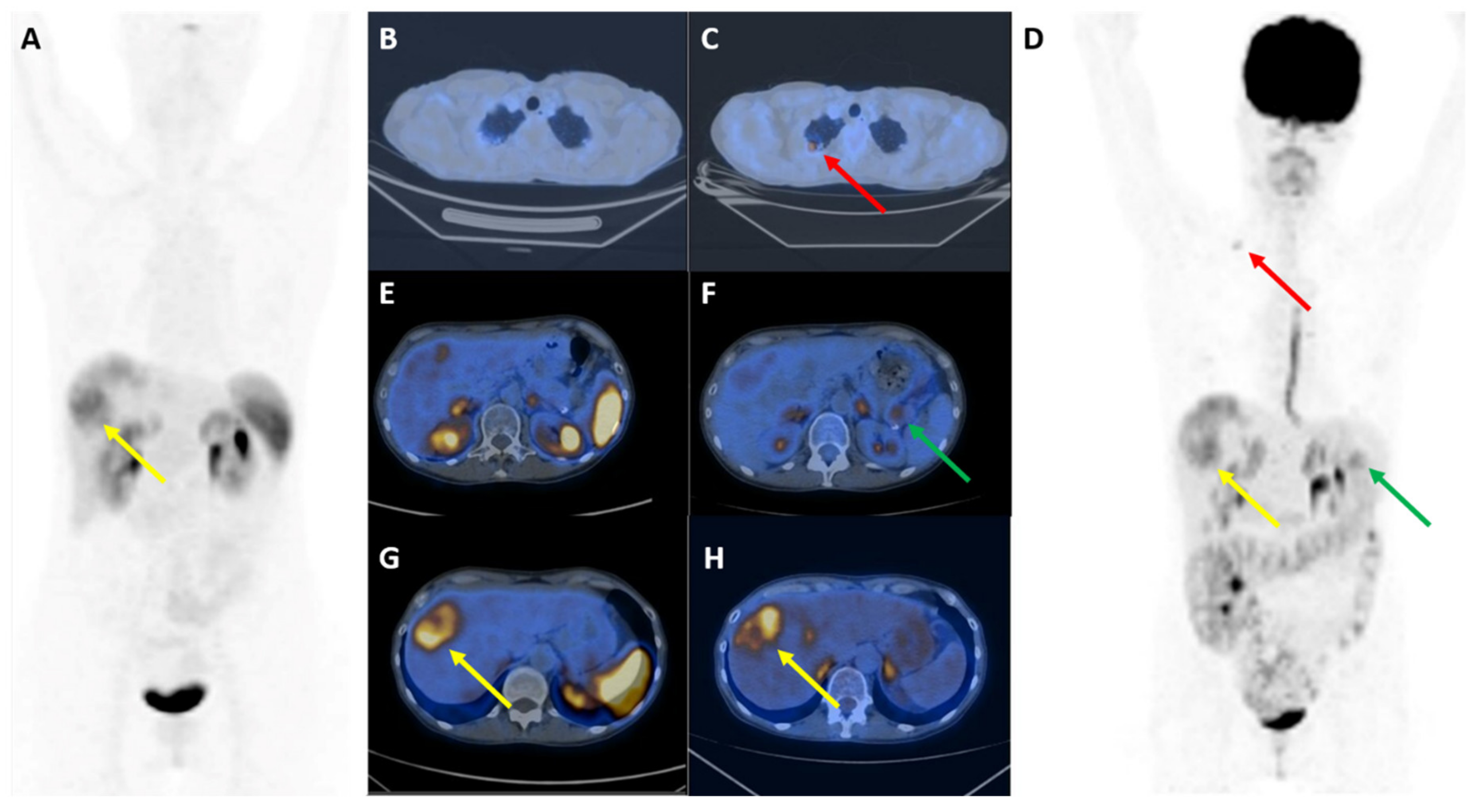 Diagnostics 10 01059 g002
