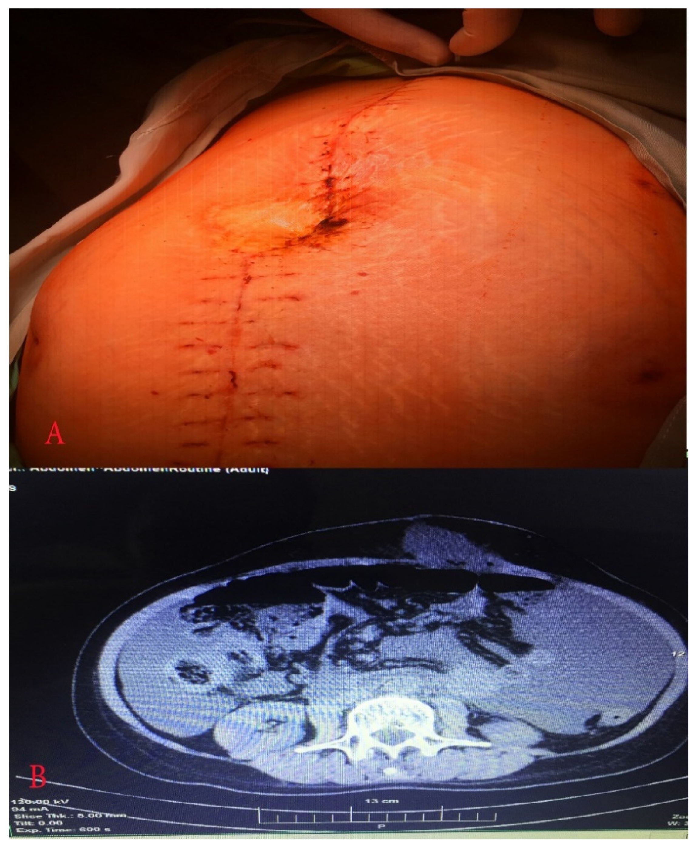 Diagnostics 10 01073 g005 Diagnostics 10 01073 g005