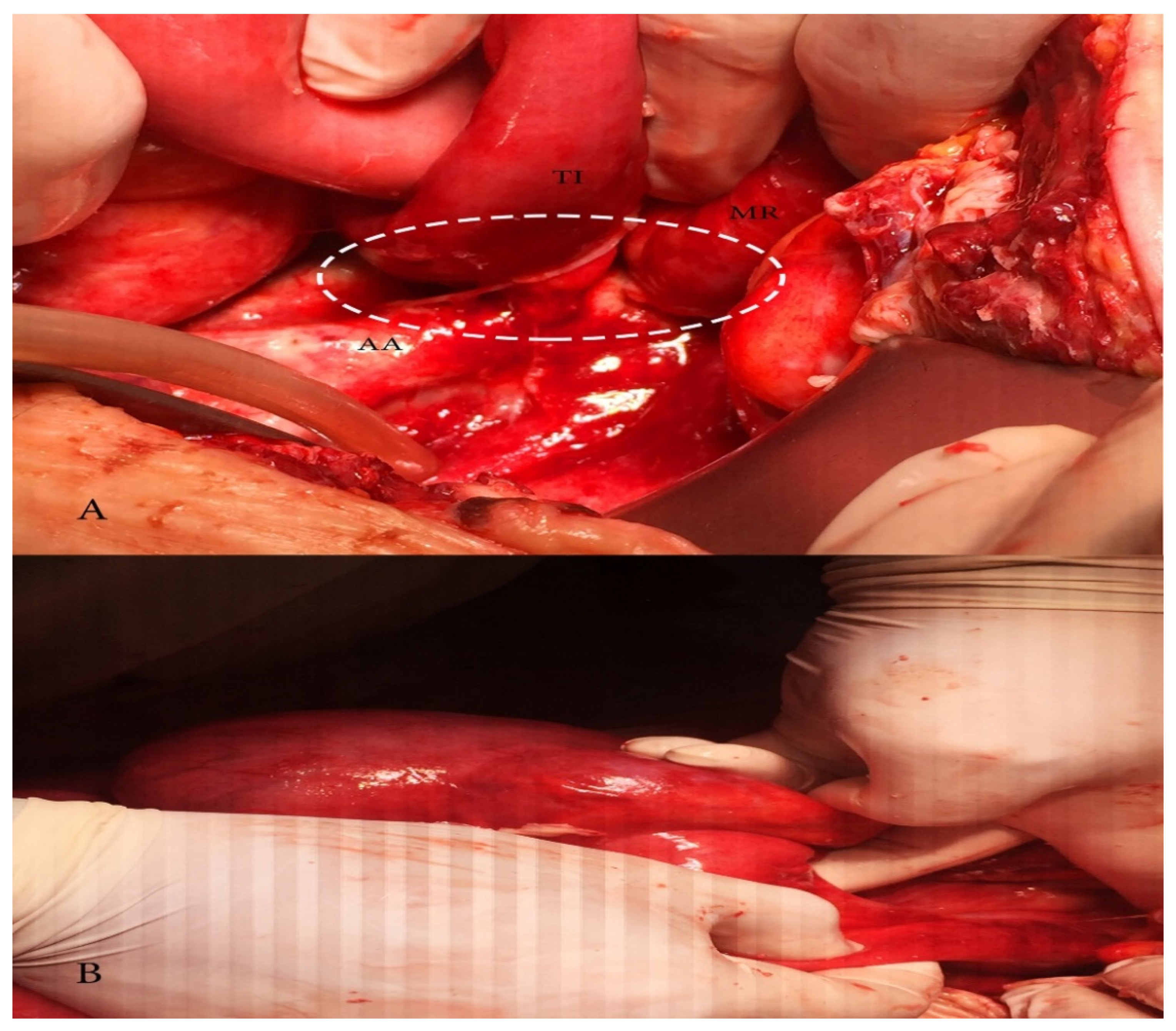 Diagnostics 10 01073 g006 Diagnostics 10 01073 g006