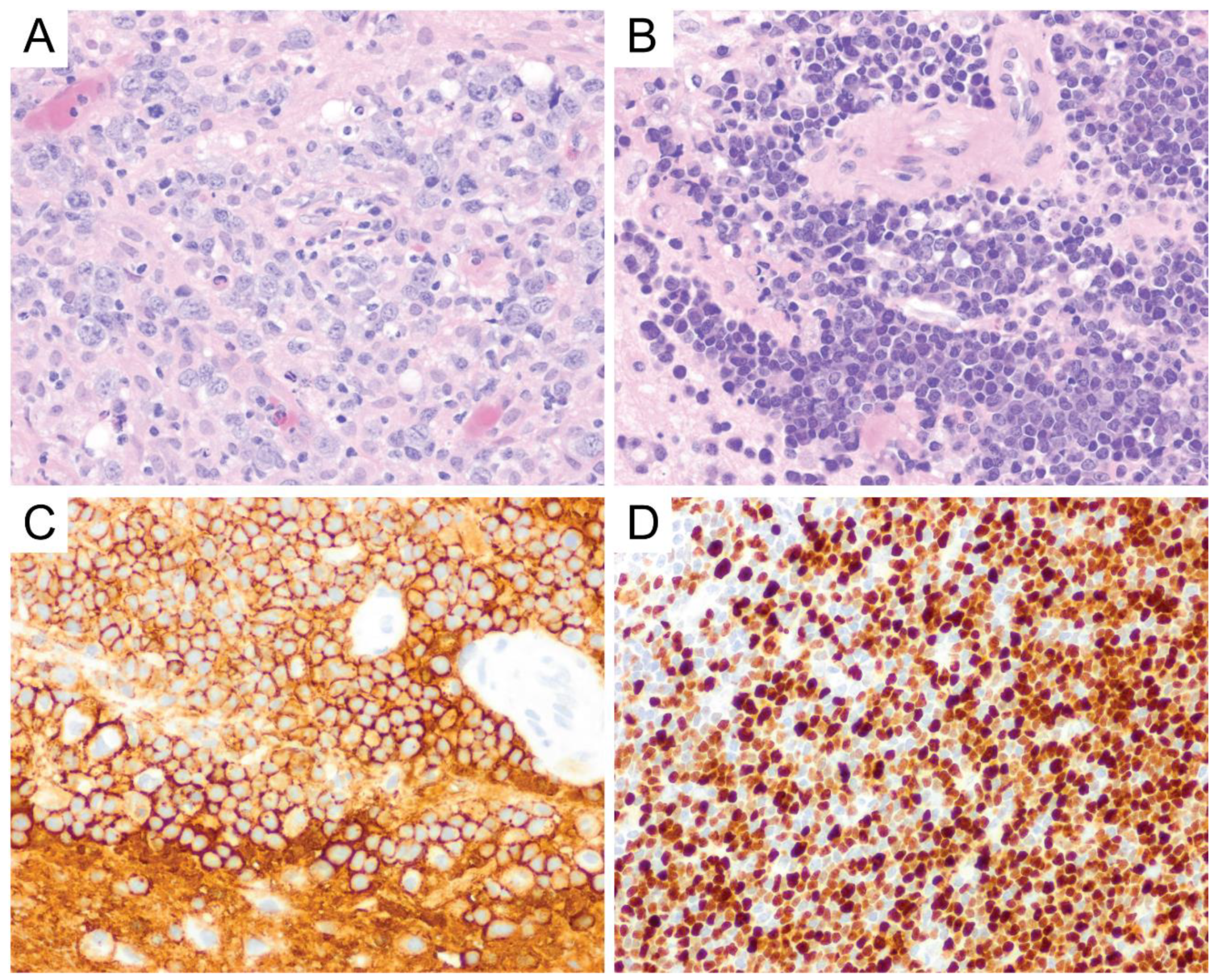 Diagnostics 10 01076 g004 Diagnostics 10 01076 g004