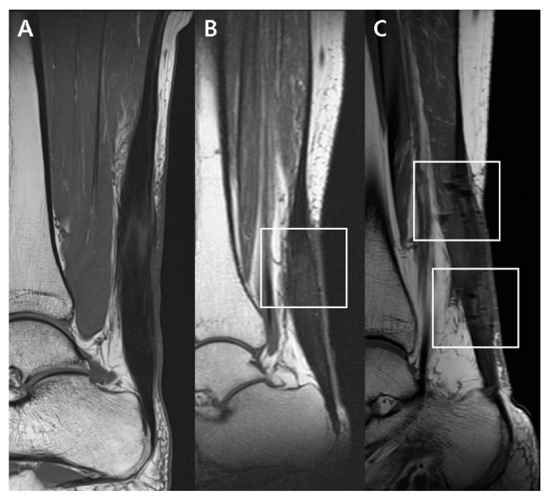 Diagnostics 10 01085 g003 Diagnostics 10 01085 g003