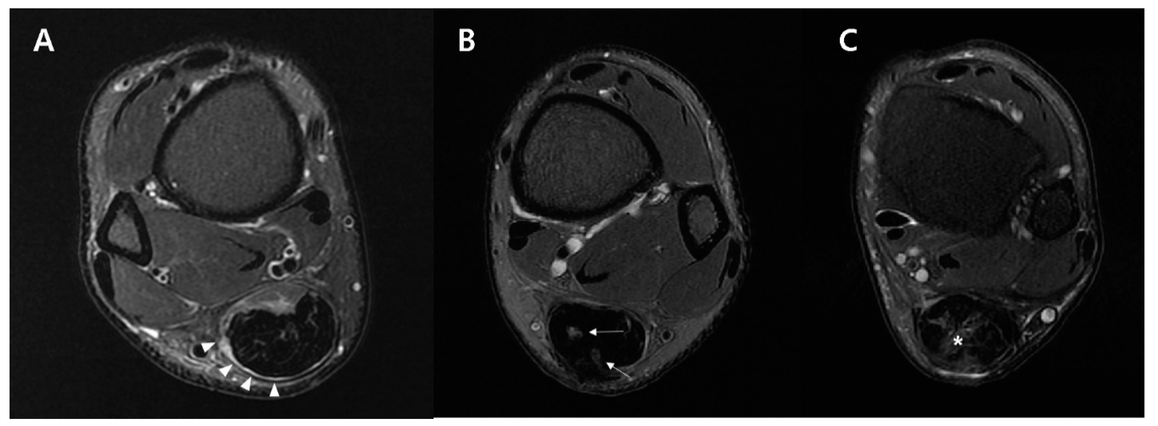 Diagnostics 10 01085 g004 Diagnostics 10 01085 g004