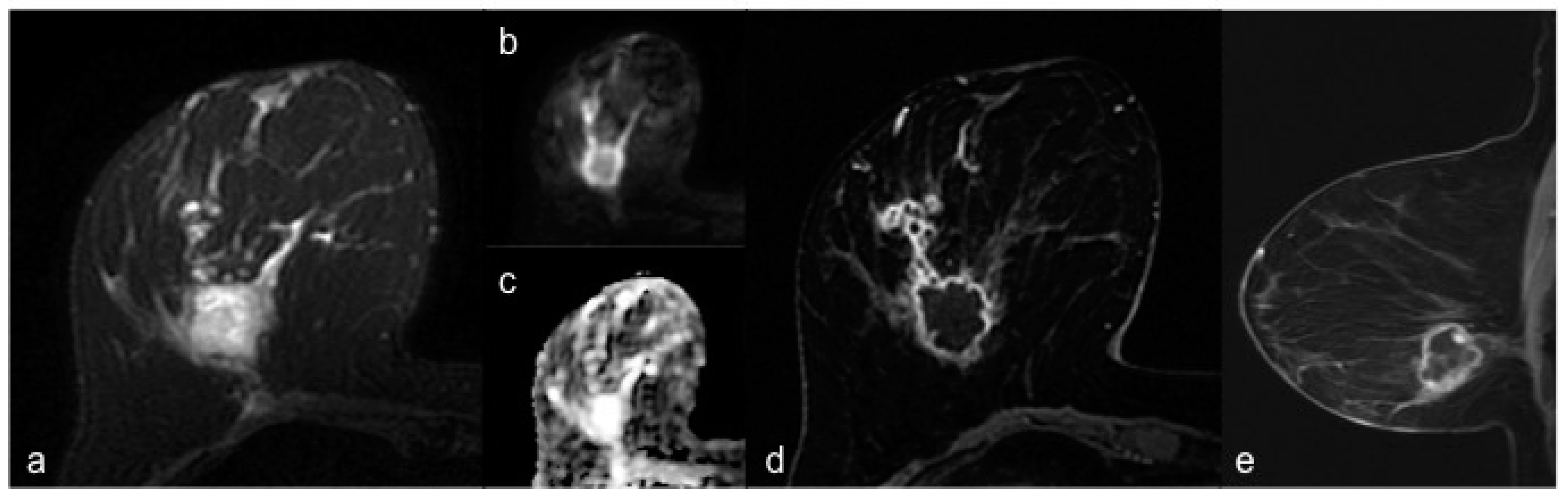 Diagnostics 10 01090 g002 Diagnostics 10 01090 g002