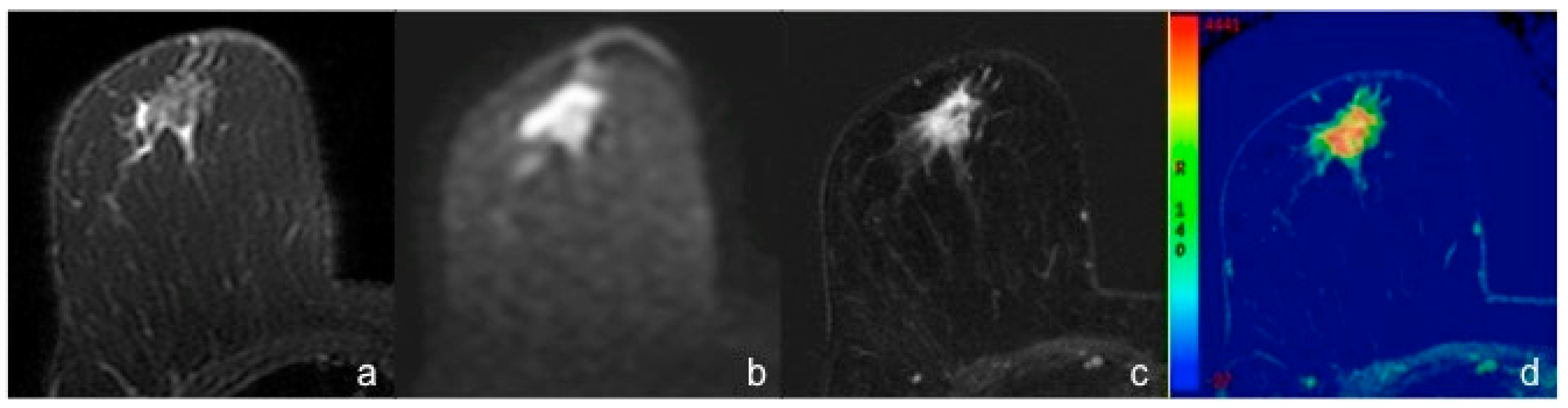 Diagnostics 10 01090 g003 Diagnostics 10 01090 g003