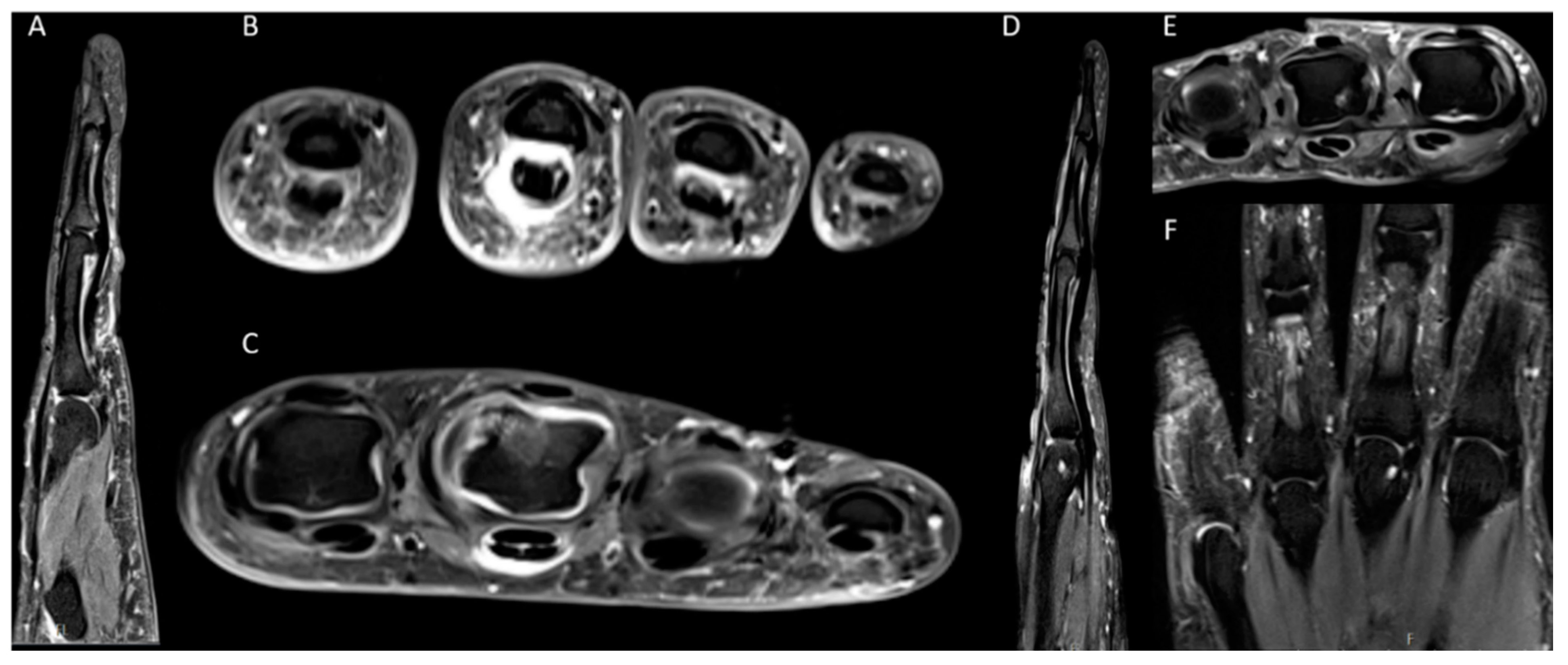 Diagnostics 10 01093 g002 Diagnostics 10 01093 g002