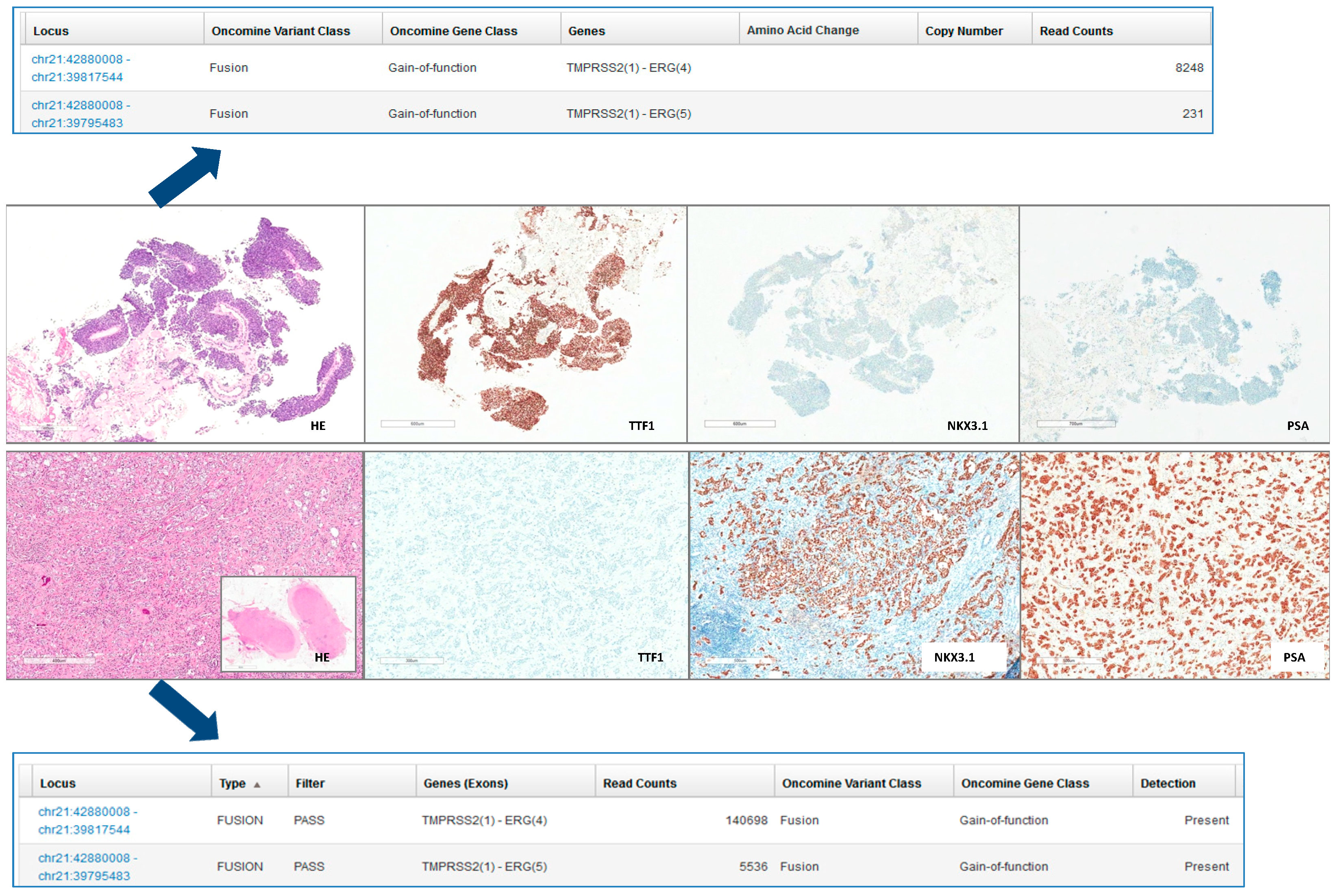 chronic obstructive pulmonary disease icd 10 code