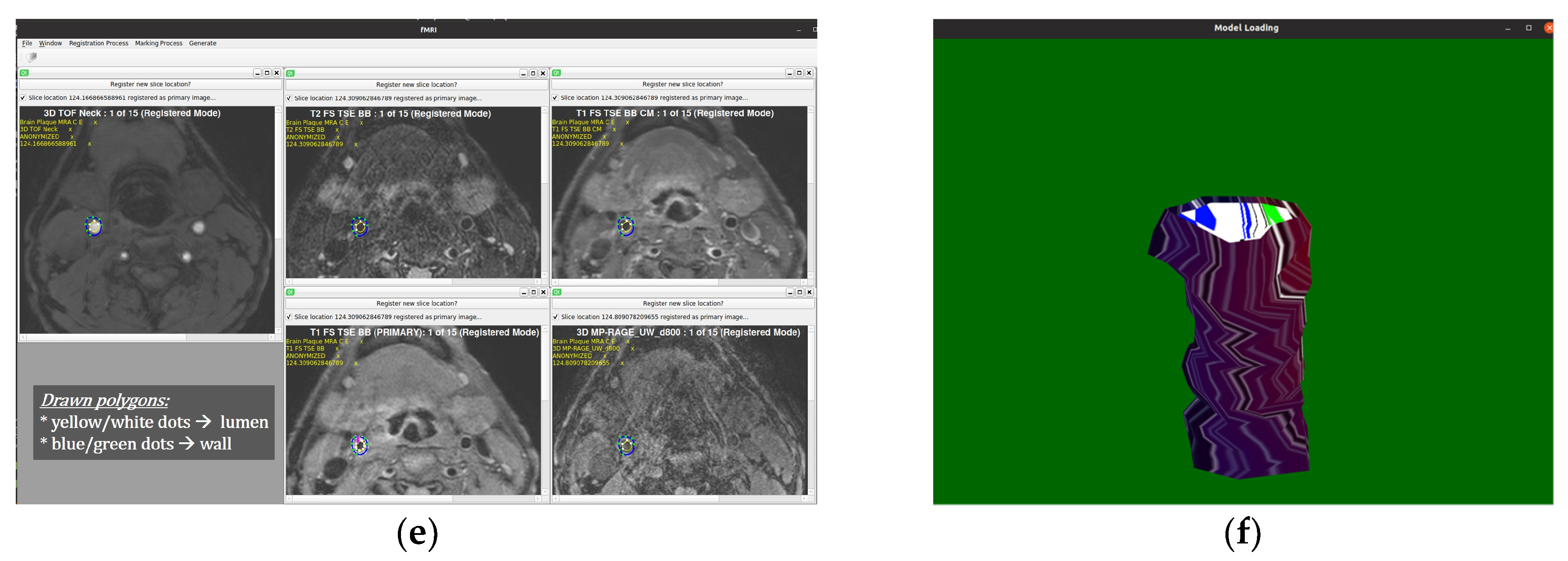 Diagnostics 10 01111 g008b