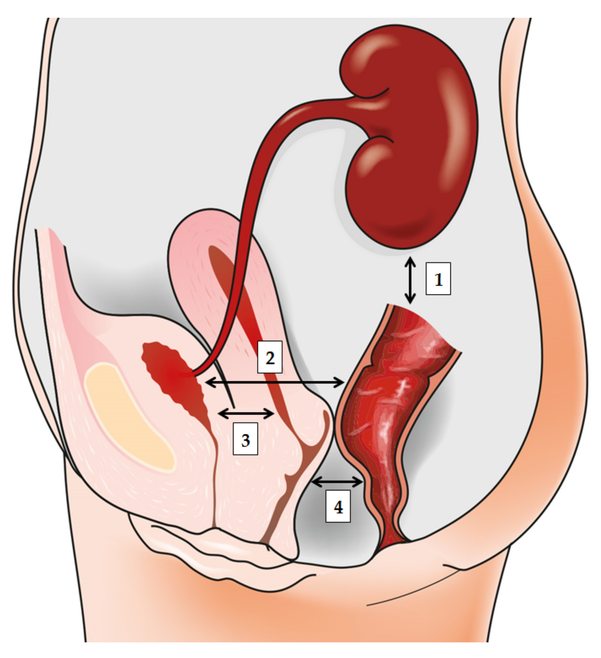 Diagnostics Free Full-Text The Role of Gut, Vaginal, and Urinary Microbiome in Urinary Tract Infections From Bench to Bedside