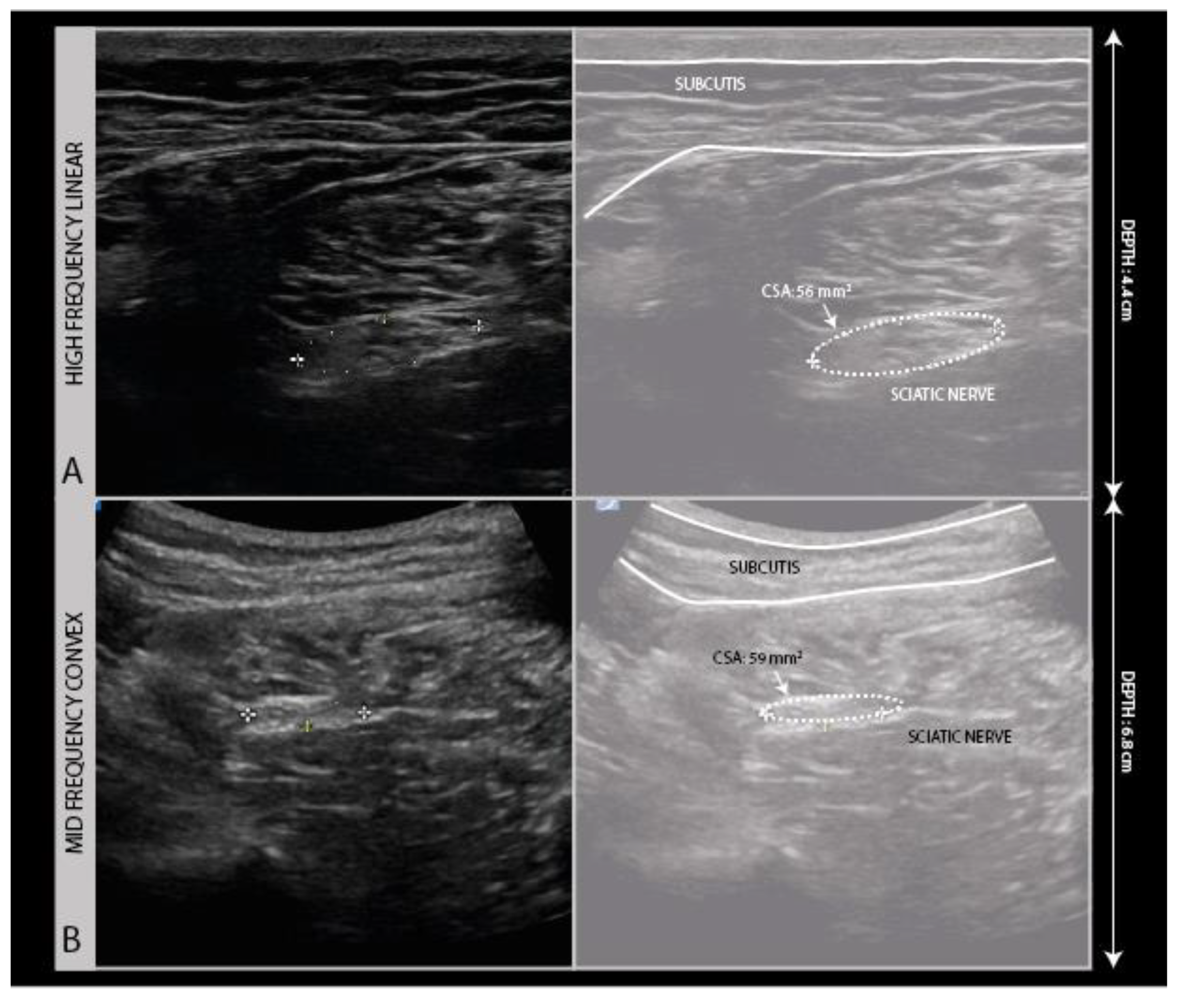 Diagnostics 11 00030 g002