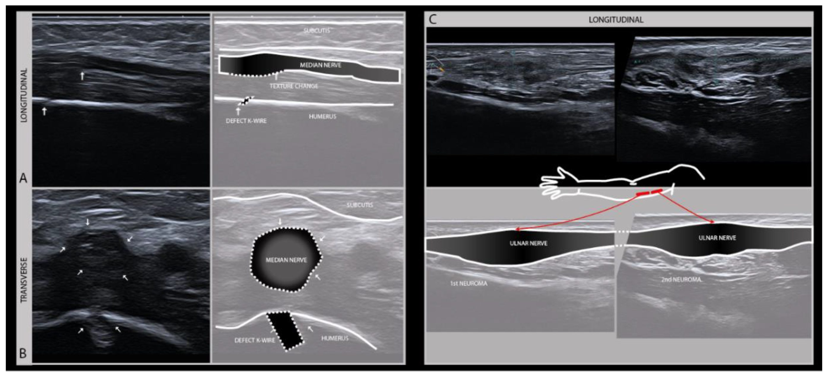Diagnostics 11 00030 g005