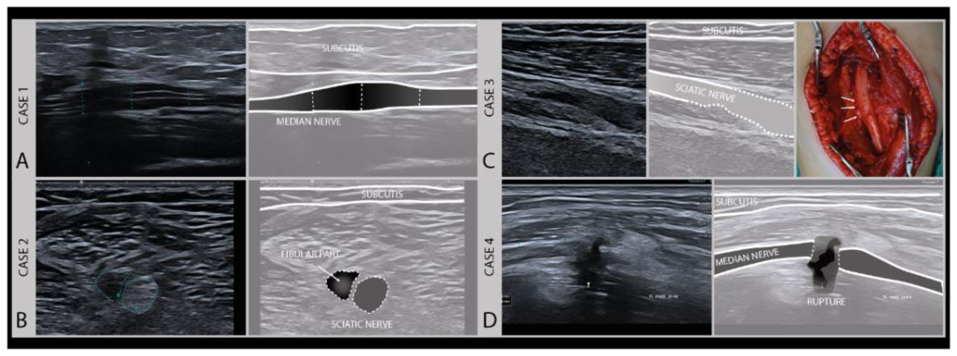 Diagnostics 11 00030 g006