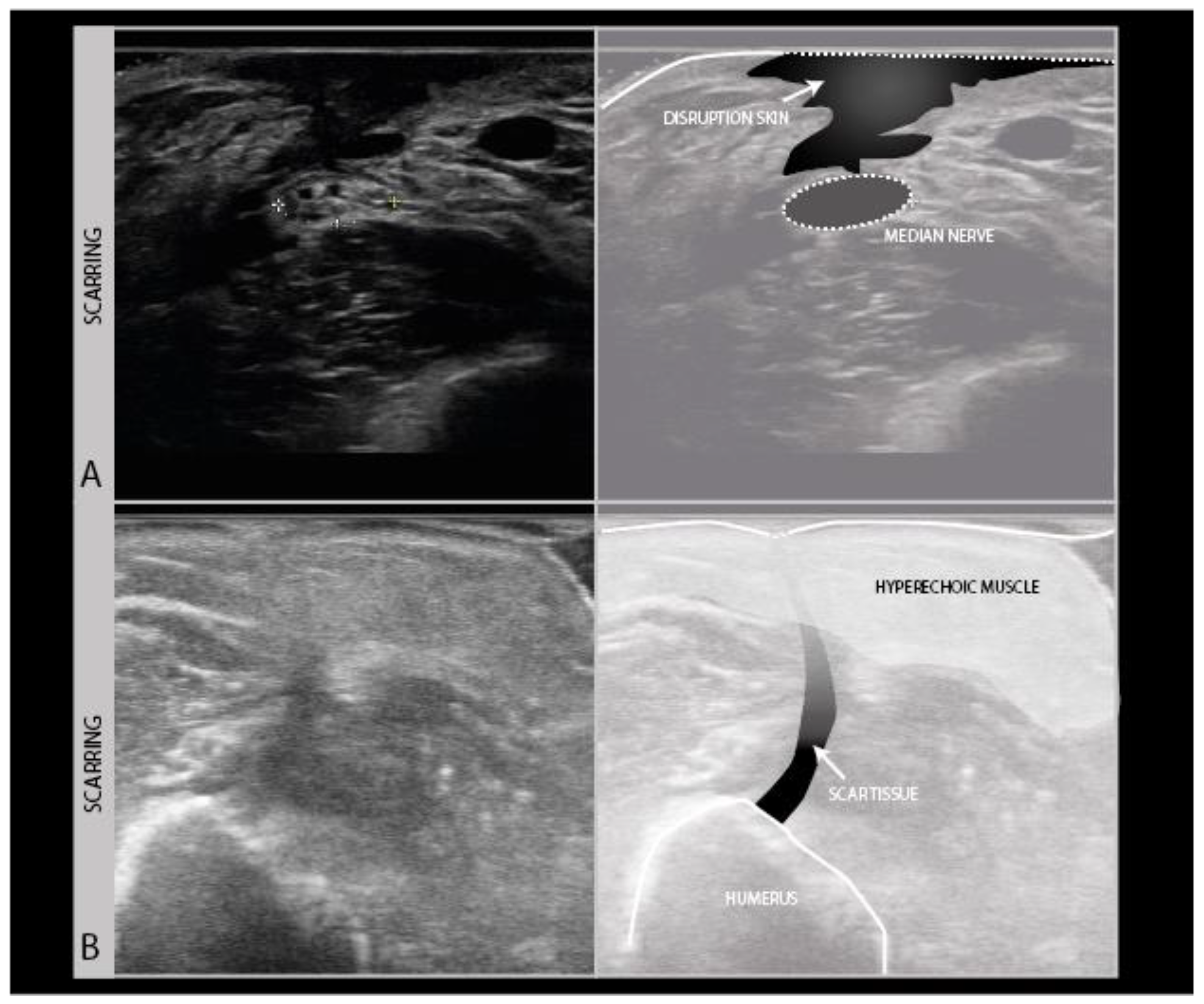 Diagnostics 11 00030 g008