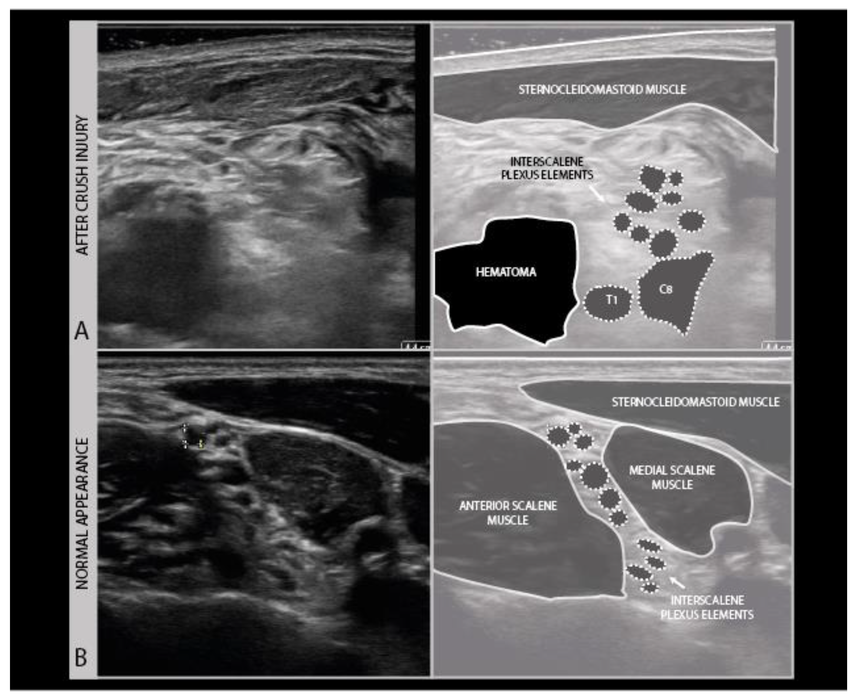 Diagnostics 11 00030 g012