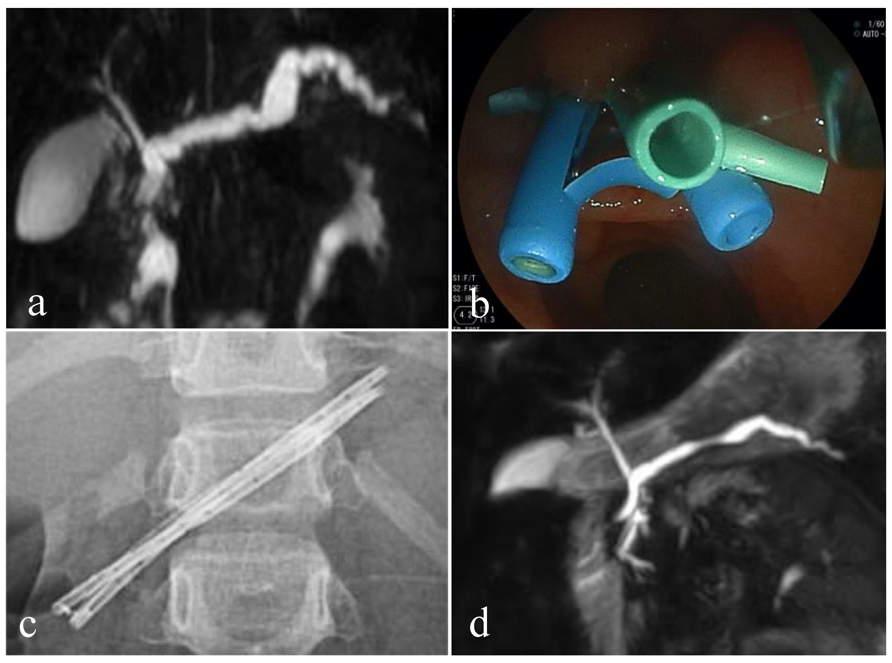 Diagnostics 11 00031 g002 Diagnostics 11 00031 g002