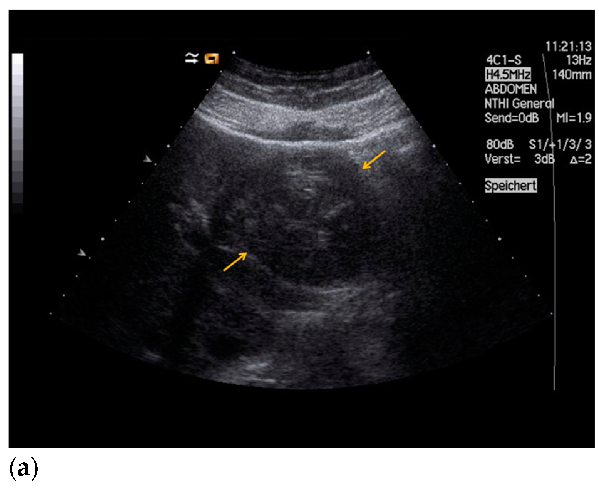 Diagnostics 11 00035 g002a