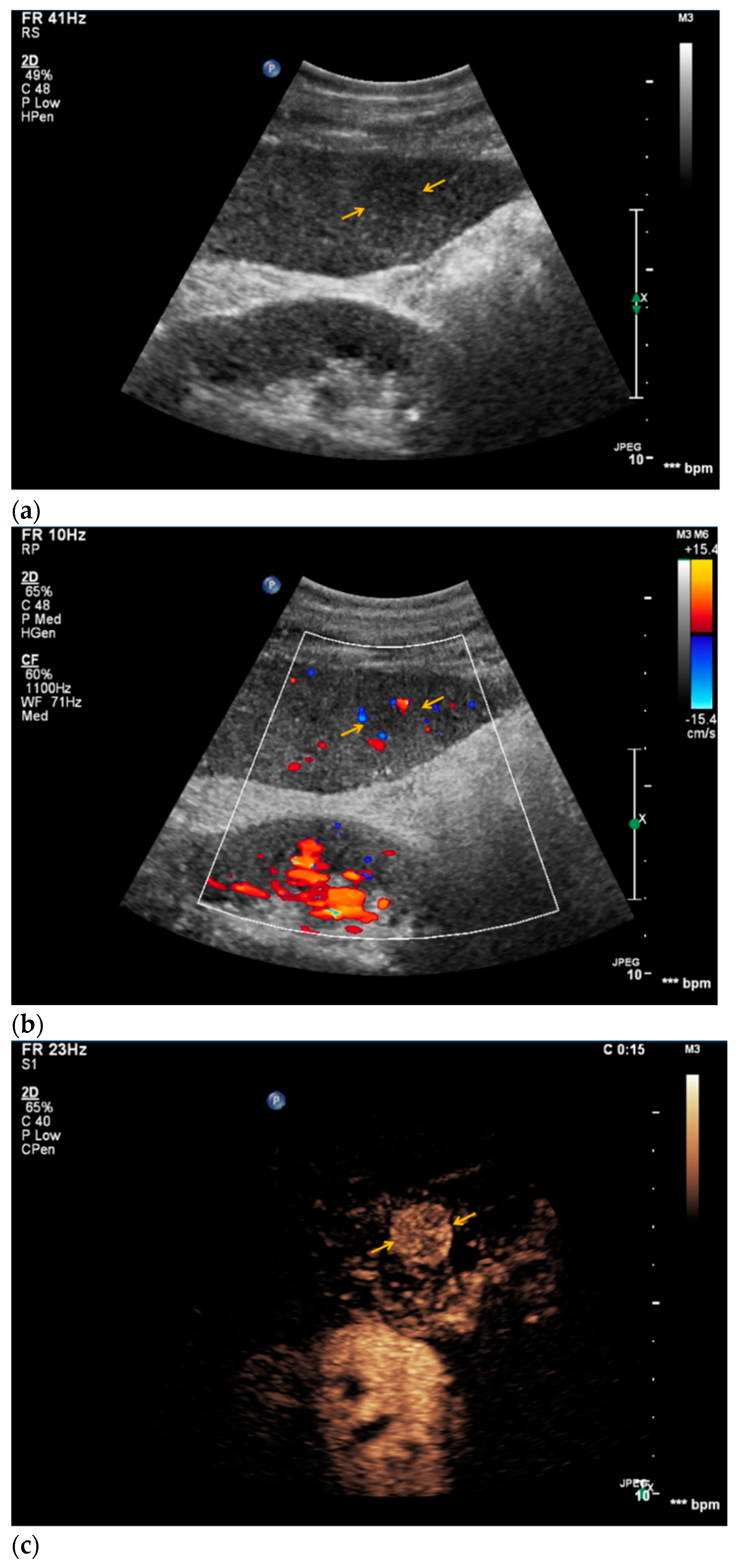 Diagnostics 11 00035 g005a
