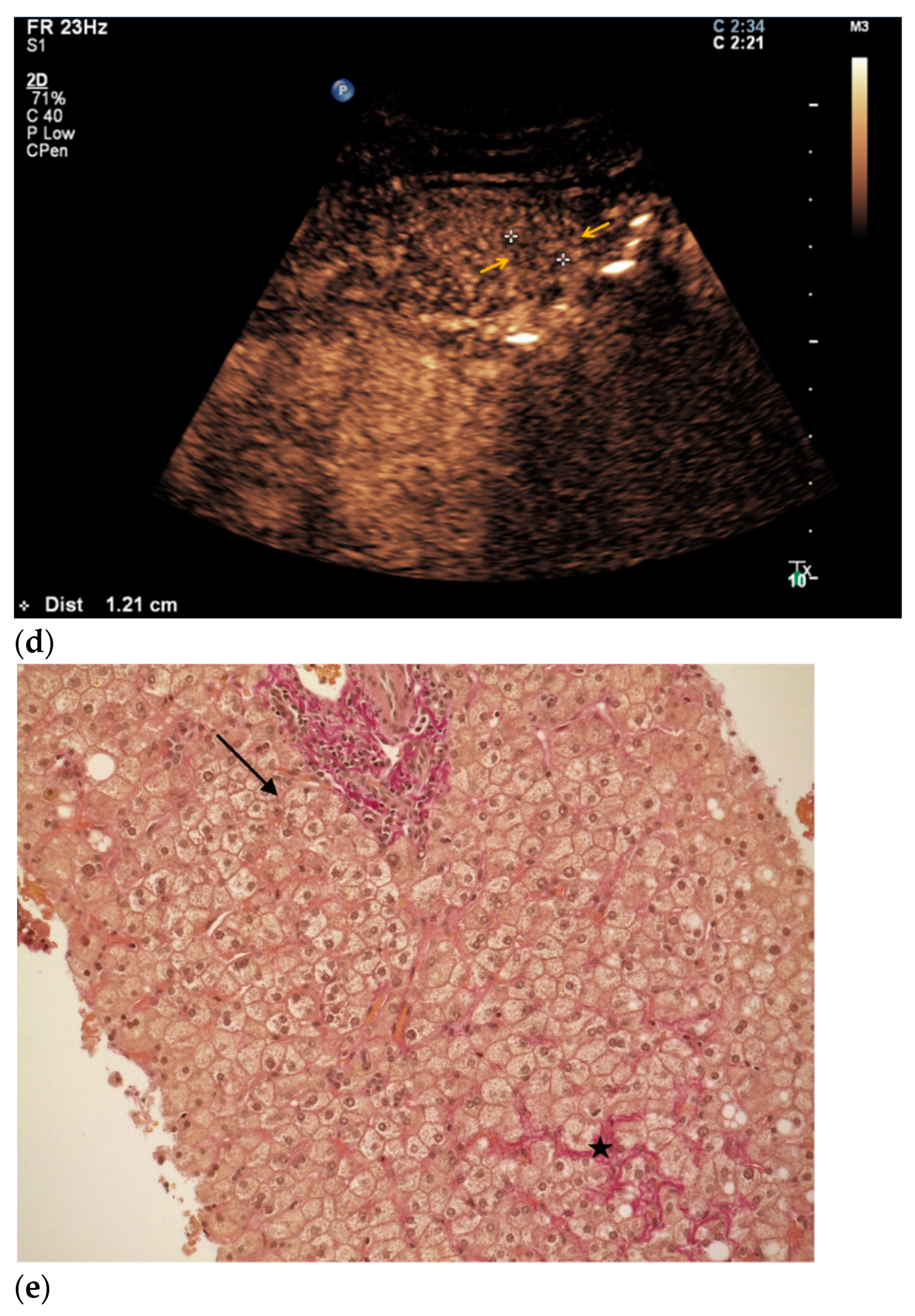 Diagnostics 11 00035 g005b