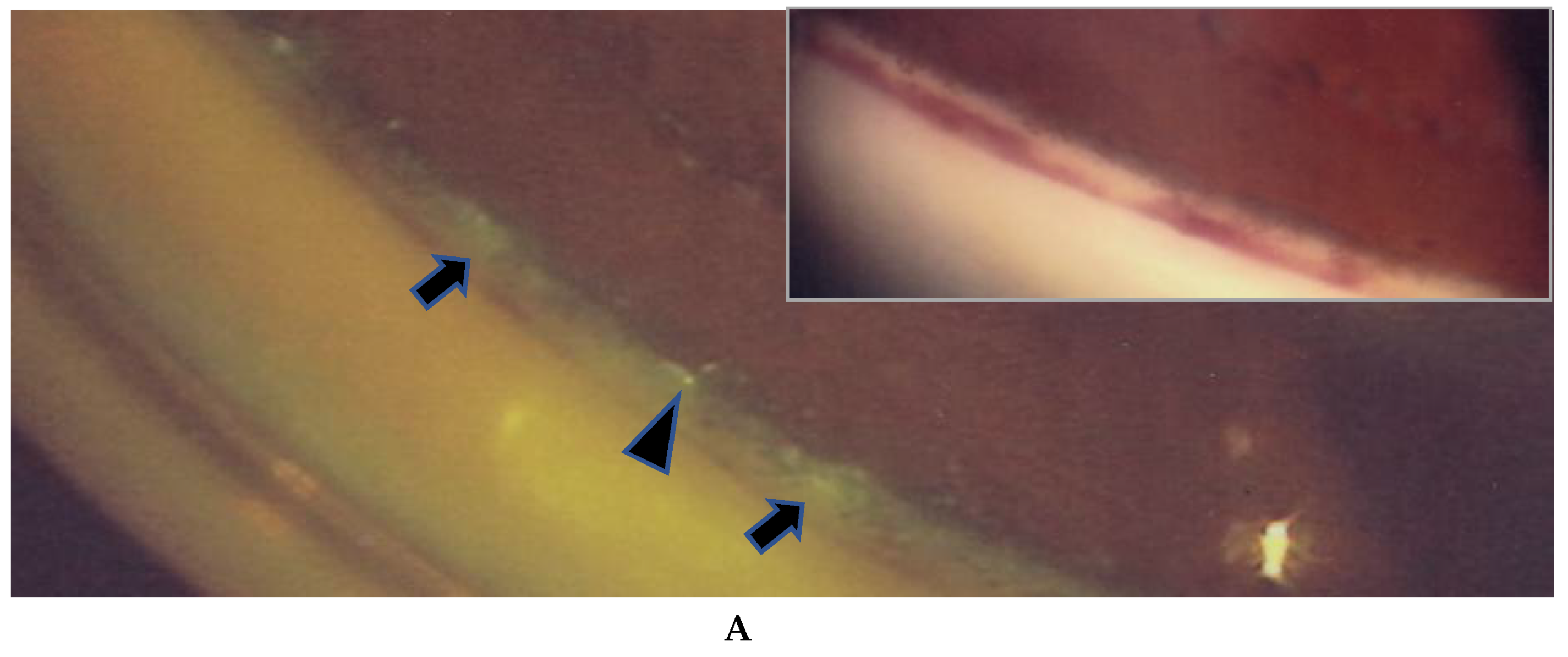 Diagnostics 11 00039 g002a