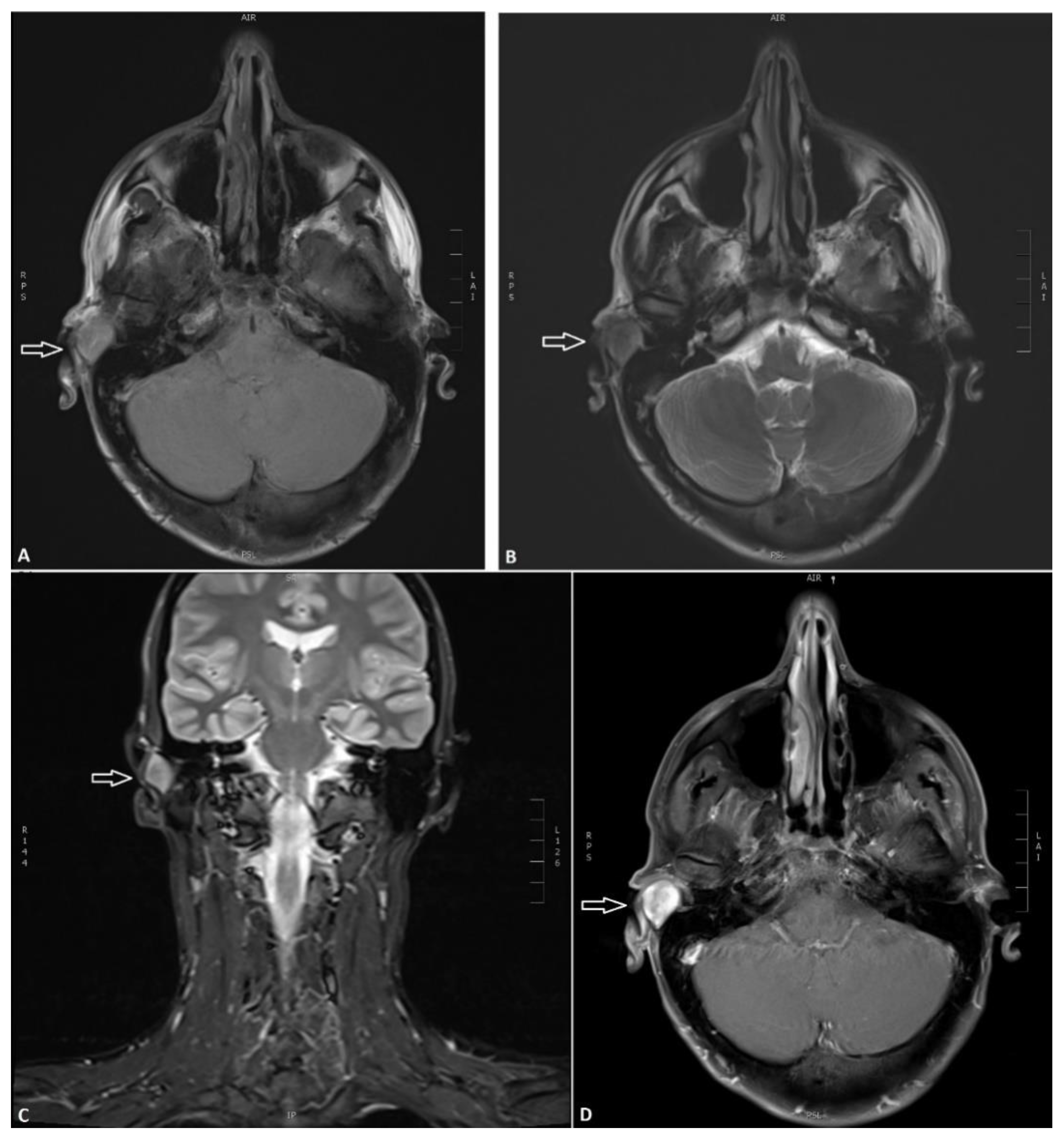 Diagnostics 11 00062 g001 Diagnostics 11 00062 g001