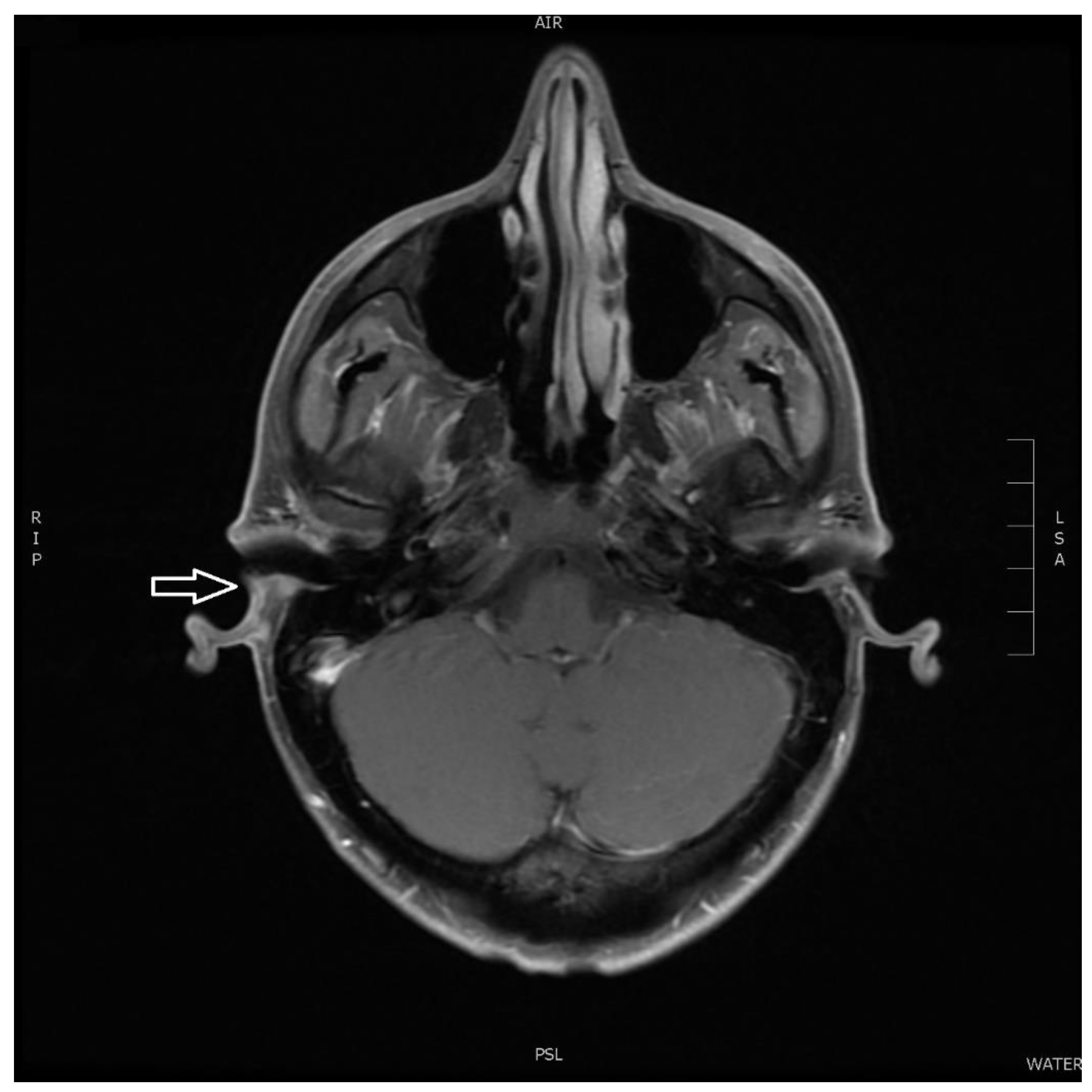 Diagnostics 11 00062 g009 Diagnostics 11 00062 g009