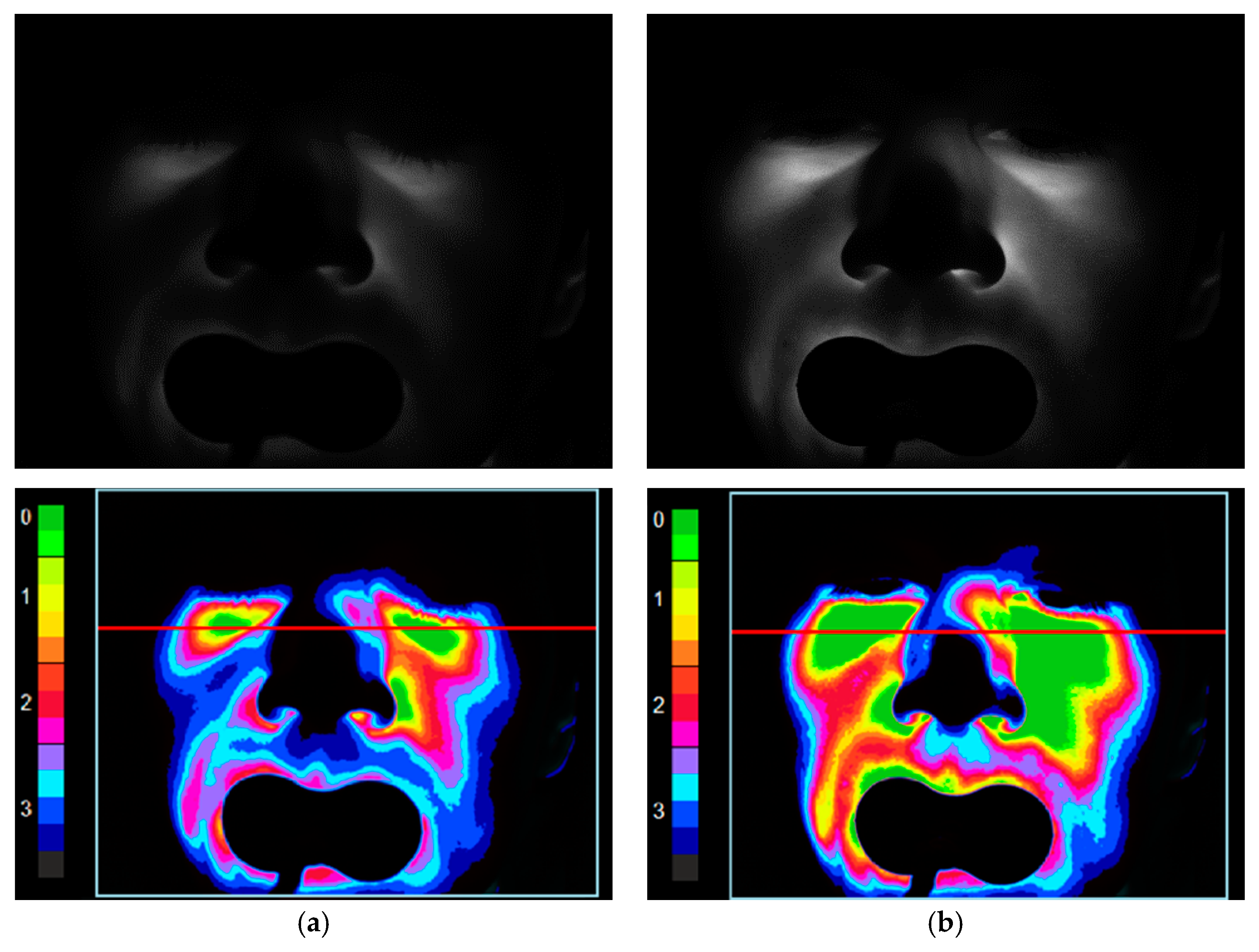 Diagnostics 11 00077 g002 Diagnostics 11 00077 g002