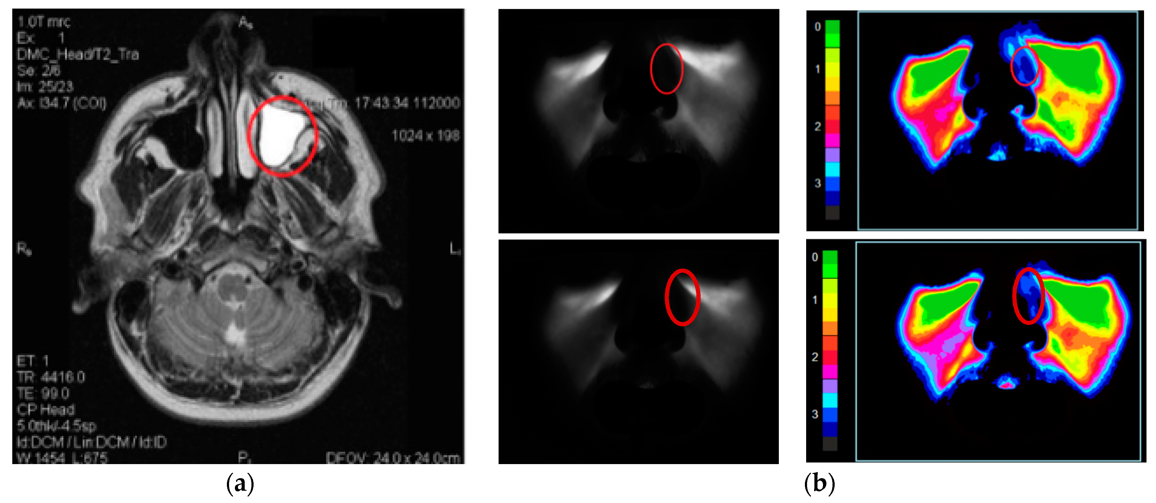 Diagnostics 11 00077 g004 Diagnostics 11 00077 g004