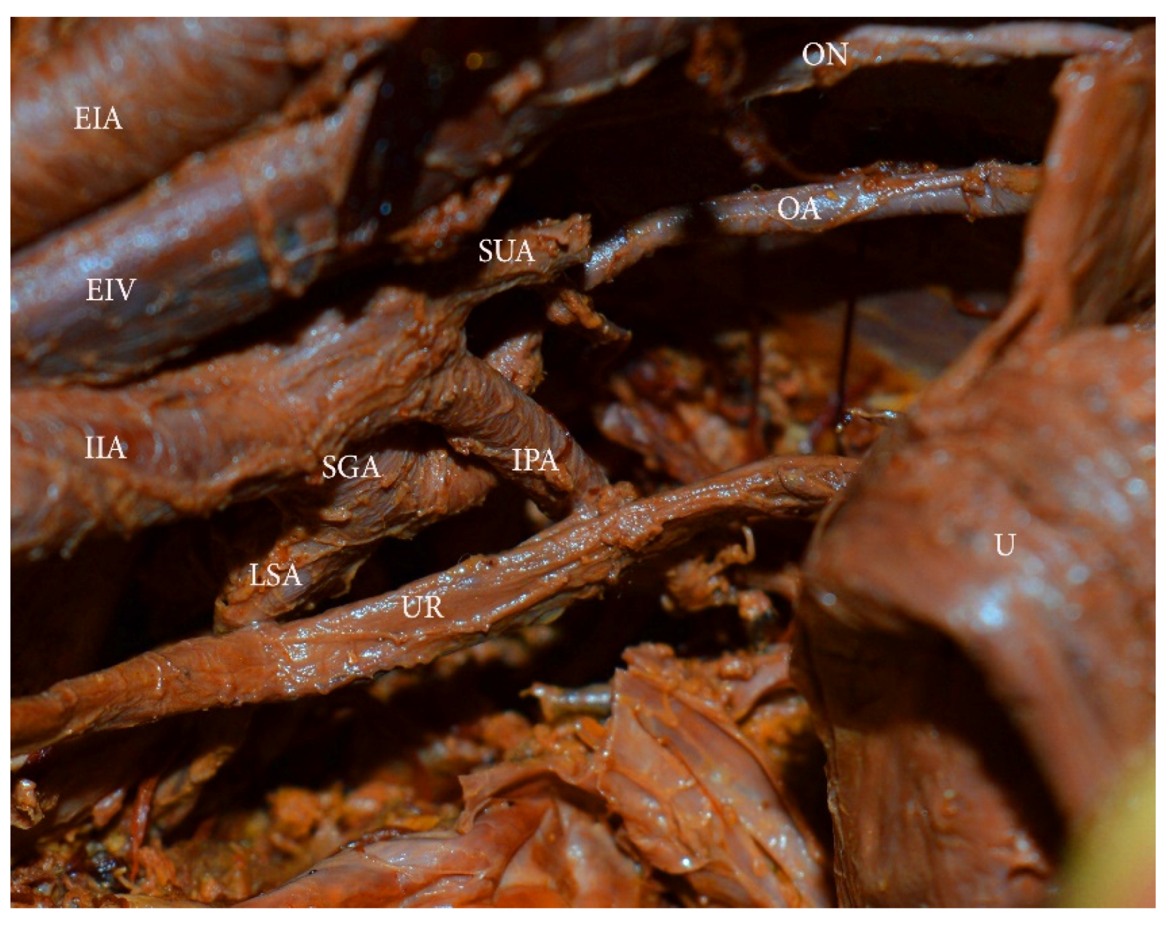 Diagnostics 11 00089 g012