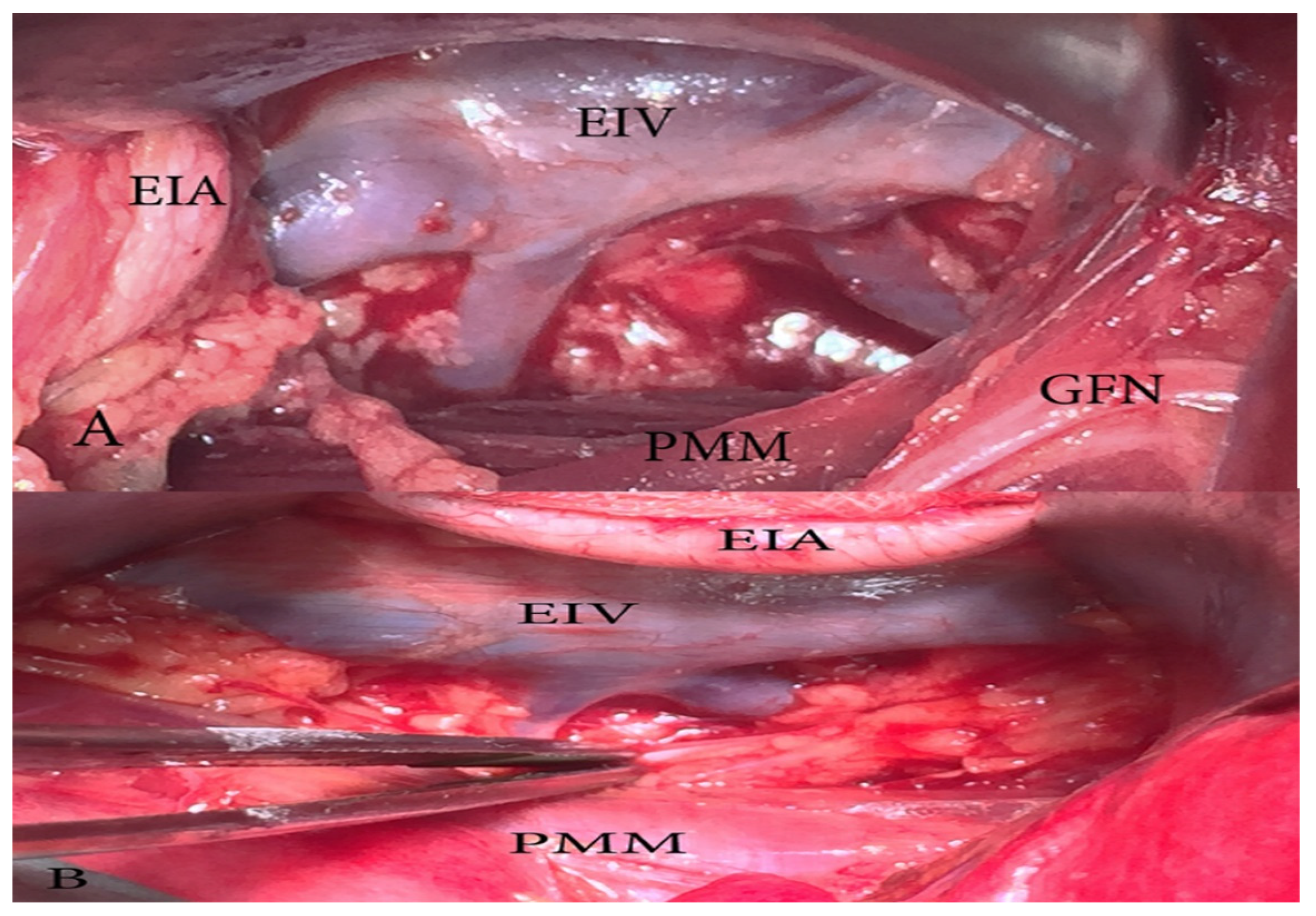 Diagnostics 11 00089 g015