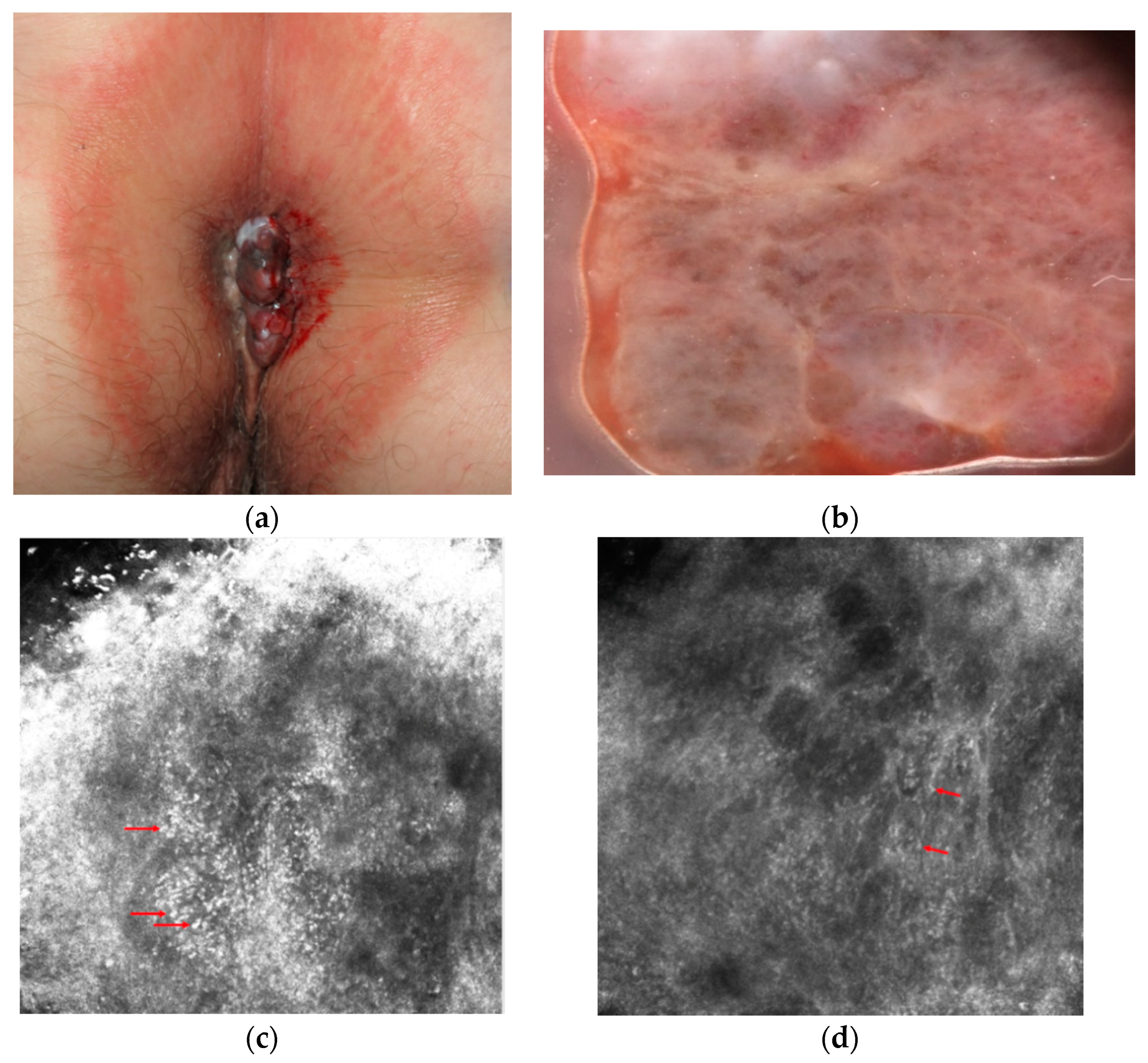 Diagnostics 11 00091 g001 Diagnostics 11 00091 g001
