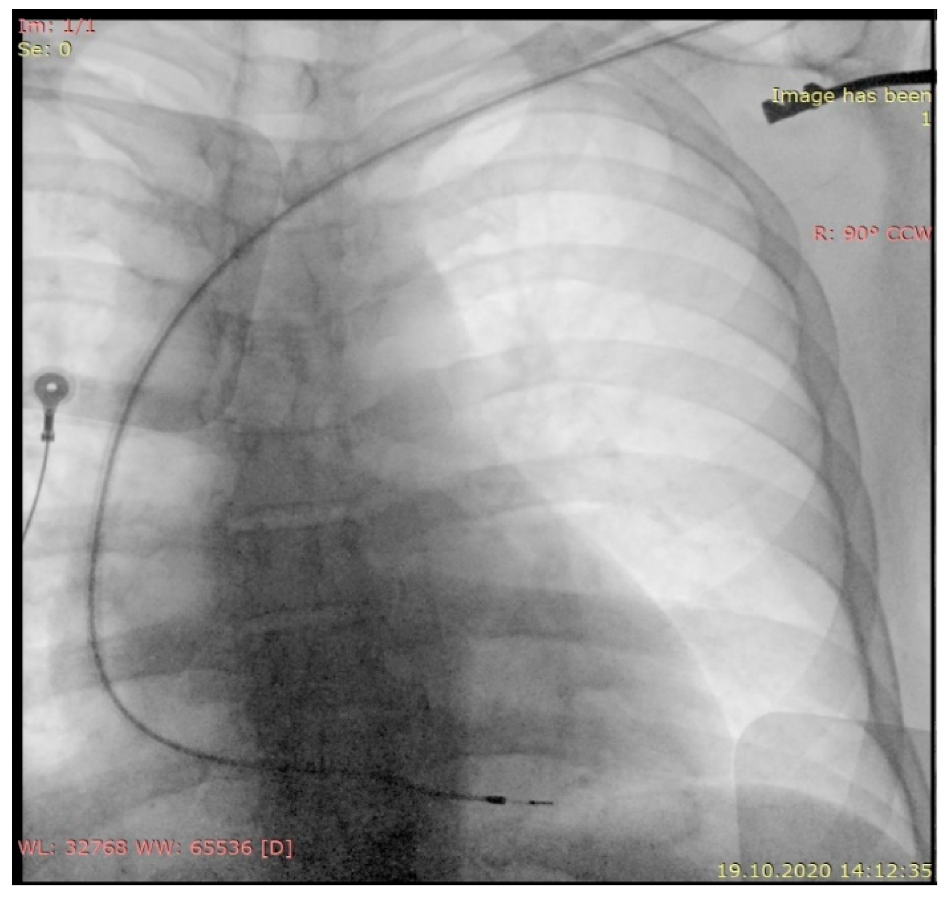 Diagnostics 11 00096 g002
