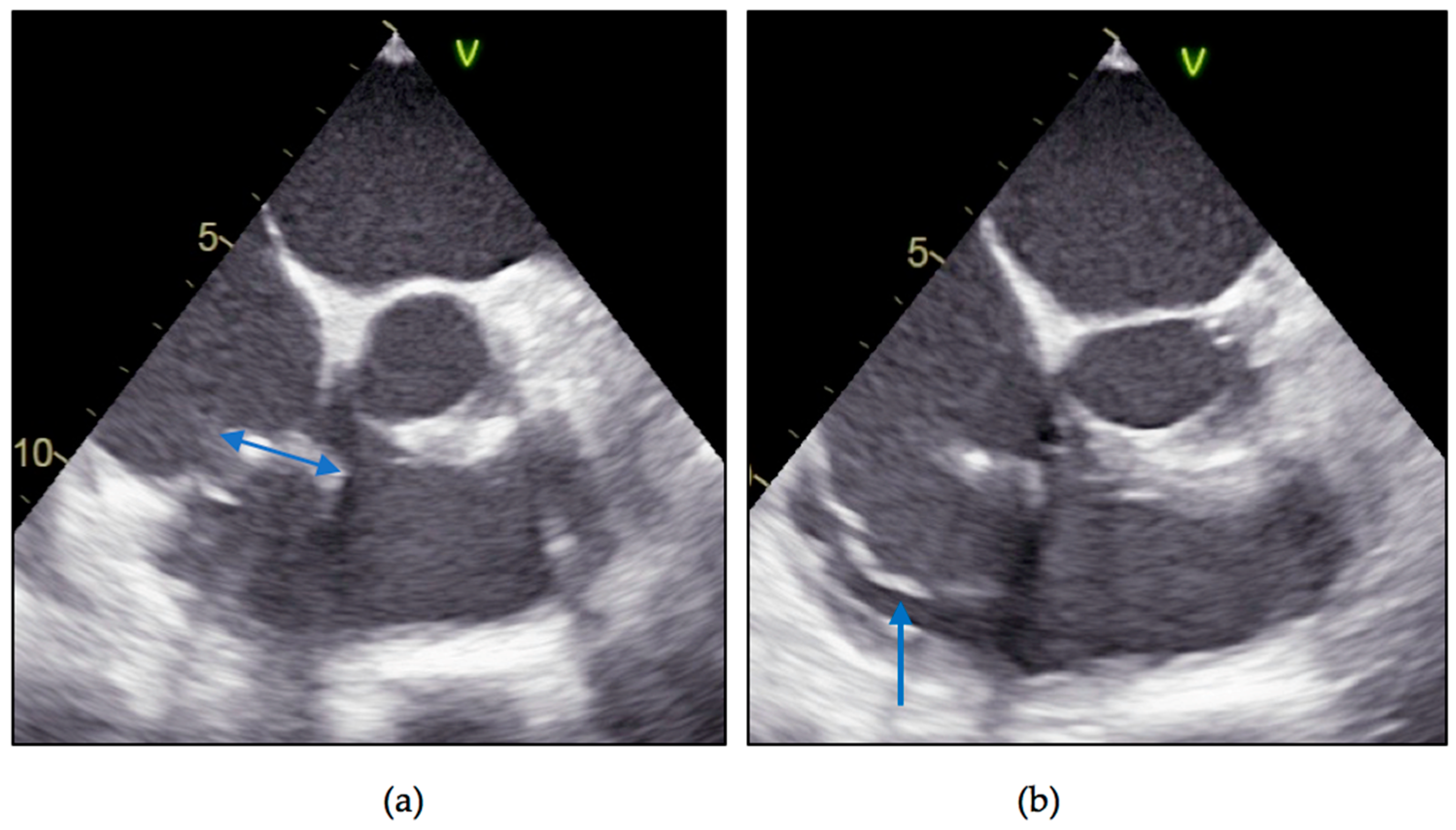 Diagnostics 11 00096 g004